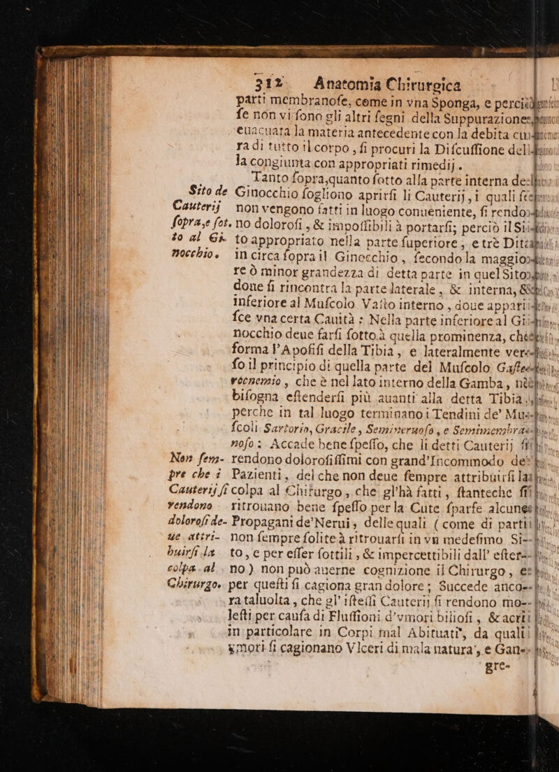 31%. Anatomia Chirurgica | parti membranofe, come in vna Sponga, e perciideni fe non vi fono gli altri fegni della Suppurazionesjano euacuata la materia antecedente con la debita cuudiim radi tutto ilcorpo, fi procuri la Difcuffione delfino la congiunta con appropriati rimedij. ki S Tanto fopra,quanto fatto alla parte interna de:lkt Sito de Ginocchio fogliono aprirft li Cauterij, 1 quali fcehn Cauterij non vengono fatti in luogo conuéniente, fi rendordki fopra,e fot. no dolorofi , & impoffibili à portarfi; perciò il Sii: to al Gi to appropriato nella parte fuperiore, e trè Diteakuil.; mocchio. incircafoprail Ginecchio, fecondola Maggio re ò minor grandezza di detta parte in quel Sitogshitt done fi rincontra la parte laterale, & interna, &hiom Inferiore al Mufcolo Vaîto interno , doue appatiidete fce vna certa Cauità » Nella parte inferioreal Gibb. nocchio deue farfi fotto.à quella prominenza, chéékkii, forma PApofifi della Tibia, e lateralmente vers fo il principio di quella parte del Mufcolo Gaffeskai rocnemio, che è nellato interno della Gamba, nèèbià., bifogna eftenderfi più auanti alla detta Tibia slim: perche in tal luogo terminano i Tendini de’ Mus-km, 4 {coli Sartoria, Gracile, Seminermofo; e Semsimenabras Bin: nofo: Accade bene fpeffo, che li detti Cauterij fp, Non fem- rendono dolorofiflimi con grand’Incommodo det kh. pre che i Pazienti, delche non deue fempre attribuirfilaiky, Cauteriy fî colpa al Chiturgo , che el'hà fatti s ftanteche fi” iu Ù i) vendono - ritrouano bene fpeflo perla Cute fparfe alcunegtk},.. dolorofî de- Propagani de’Nerui; delle quali (come di partiifiy,.i ue attri- non fempre foliteà ritrouarfi in vn medefimo Siî--hi. buirfi la to,e perefferfottili, & impercettibili dall’ eftere-h.! Vf colpa-al , no) non può auerne cognizione il Chirurgo; 2h. CH Chirurgo. per quefti fi cagiona gran dolore; Succede anco--h | NE | rataluolta, che gl’ ifteli Cauteriy fi rendono mo-- li}, ill iii lefti per caufa di Fluffioni d’vmori biliofi , &actli Ma MIC a inparticolare in Corpi inal Abituat® da qualii }y, LINA INI xmori fi cagionano Vlceri di mala natura‘, e Gan ky, BilT gre- | ti )