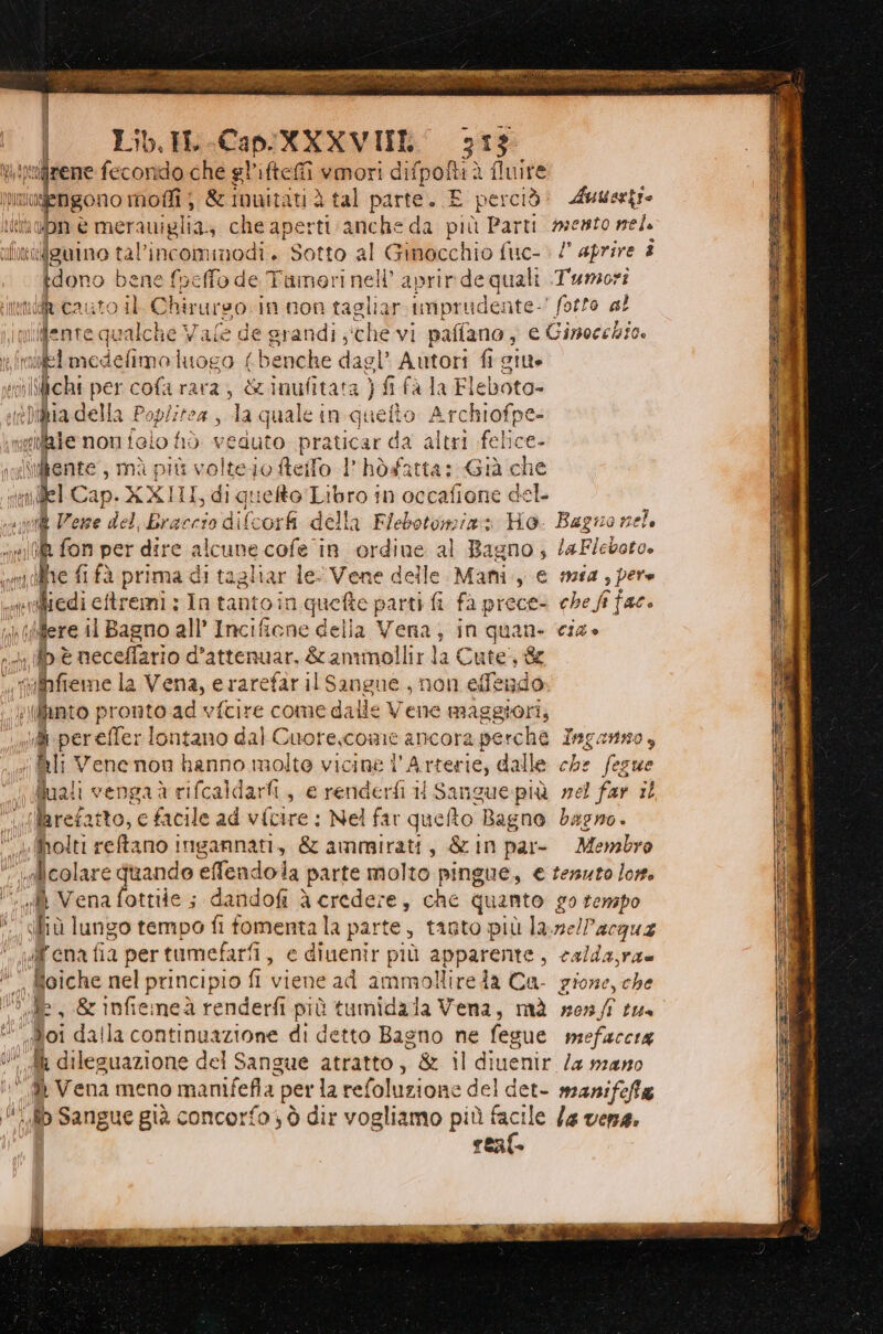 Lib. IL Cap. NXXVIIL' 313 jrene fecondo che gl’iftefi umori Rea paola fluire MRO mersuigl ; &amp;imuitati è tal parte. E perciò snai itnabn è merauiglia: che aperti anche da più Parti En) nel clonati Isuino tali incominodi. Sotto al Ginocchio fisc- > /° aprire 4 * ono bene fpeffo de Tuino ri nell aprir pla Tumori necauto il Chirurso. in non tagliar imprudente.’ fotto al lilente qualche Vale de grandi ;che vi paffano ; «Ginocsbio, niidimodetiro log o {benche dagl’ Autori fi giu» ilichi per cofa rara; &amp;.inufitata } fi fa la Fleboto- via dell Paptinao da quale in quefto Archiofpe- «ifaie non folio fiò | duto praticar da altri felice- del Cap. XXIII, di quefto Libro in occafione del ai ca Vene del braccio di i(corfi della Flebotonia=» Ho. Bagno nel ie; fon per dire alcune cofe in ordine al Bagno; /aF/eboto. oi dflre fi fà prima di tagliar le- Vene delle Mani, € mia ; pere sonfiedi eremi vIn tantoin Lenie efte parti fi fà prece- che fi fac. ilfere il Bagno all’ Incifiene delia Vena, in quan cia» 1; fp è neceffario d’attenuar, &amp; ammollir la Cute”, &amp; | si eten la Vena, erarefaril Sangue, non efendo. illinto pronto ad vfcire come dalle Vene maggiori, i. pereffer lontano dal ( Cuore,come ancora perche Tagarno, Bi Vene non hanno molto vicine l' Arterie, dalle che fegue fuali venga à rifcaldarfi, e renderti 11 Sangue più rel far il irefatto, c facile ad vfcire : Nel far queto Bagno bagno. Molti reftano ingannati, &amp; ammirati, &amp;in par- Membro colare qu ando effendola parte molto pingue, € tessuto lor. ‘ip Vena fottile ; dandofi à credere, che quanto go tenspo ifiù lungo tempo fi fomentala parte, tanto più la.nellacgua Wena fia pertumefarfi, e dinenir più apparente, calda,ra» sl foiche nel principio fi viene ad ammollire da Ca- gione, che U.dle , &amp; infiemeà renderfi t più tumidala Vena, mà xz0nf te © Boi dalla continuazione di detto Bagno ne fegue mefaccia ih dileguazione del Sangue atratto, &amp; il diuenir Za nano ‘4 Vena meno manifefla | per la refoluzione » del det- manifefta U.lo Sangue già concorfo) ò dir vogliamo più facile /4 vena. reaf î
