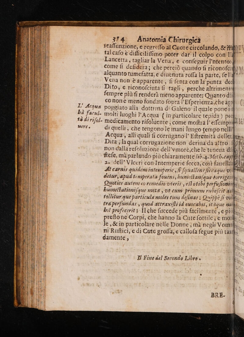 L’ Acqua bi facul. tà di rifol- UETE è 314. Anatomia Chirurgica teaffunzione, é regreffo al Cuore circolando, &amp;#@)7) tal cafo è difficiliffimo poter dar il colpo con Ila Lancetta, tagliarla Vena; e confeguir l’ntento» f come fi defidera; che perciò quando fi ritonofcedì| \V alquanto tumefatta, e dinenuta roffa la parte, fellaf** Vetia non è apparente , fi fenta con la punta deck Dito; e riconofciuta fi tagli, perche altrimenti fempre più fi renderà meno apparente: Quanto dii cononè meno fondato fopra l’Efperienza;che arpl poggiato alla dottrina di Galeno il quale pone. molti luoghi P Acqua ( inparticolare tepida) pa ii medicamento rifoluente , come moftra l’ effermpbill bi di quelli, che tengono le mani lungo temponelli Acqua, alliquali fi corriigano 1’ Eftremità delleztgna Dita ;laqual corrugazione non derinia da altro. îofa non dalla refoluzione dell’vmore;che le teneua dilbiA ftefe, mà parlando più chiaramente /i5:4.Merb.capii\i 2. dell’ Viceri con'Intemperie fecca;così fauellzal LT Hi carnis quidenz intemperie , fi fgualleni ficcague vINF4MI detur, apudtemperata fouens, bumettanigue dorrigezi TA | ì Quoties autem co remedio vieris s eStotibi perfuffonitay. bumettationifgue meta st cun primum rubefcit gal, follitur que particula nzoles tunz definas: Quippè fr vin, tra perfundas , quod attraxifti id euocabis, itaque null d; b:l profecerit: Il che fuccede più facilmente, e più. prefto de Corpi, che hanno la Cute fottile; e mos Je ,&amp; in particolare nélle Donne ; mà negli Vomil,,- ni Ruftici, e di Cute groffa; e callofa fegue più tant, damente, iL