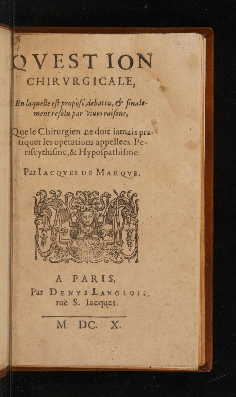 Lu 1 7: OVEST ION CHIRVRGICALE, | En laquelle eft propofé,debartu, © finale- | RO 1% | ie, Pi (| mentrejolu DAY VIUES Y4tjons | À bn P fo ? [Que le Chirurgien ne doit iamais pra- tiquer les operations appellees Pe- rifcythifme,&amp; Hypofpathifine. | Parlacoves DE MARQYE. : : M Par DenvsLancLrois, | rué S. Jacques. SE TE | M BG: X