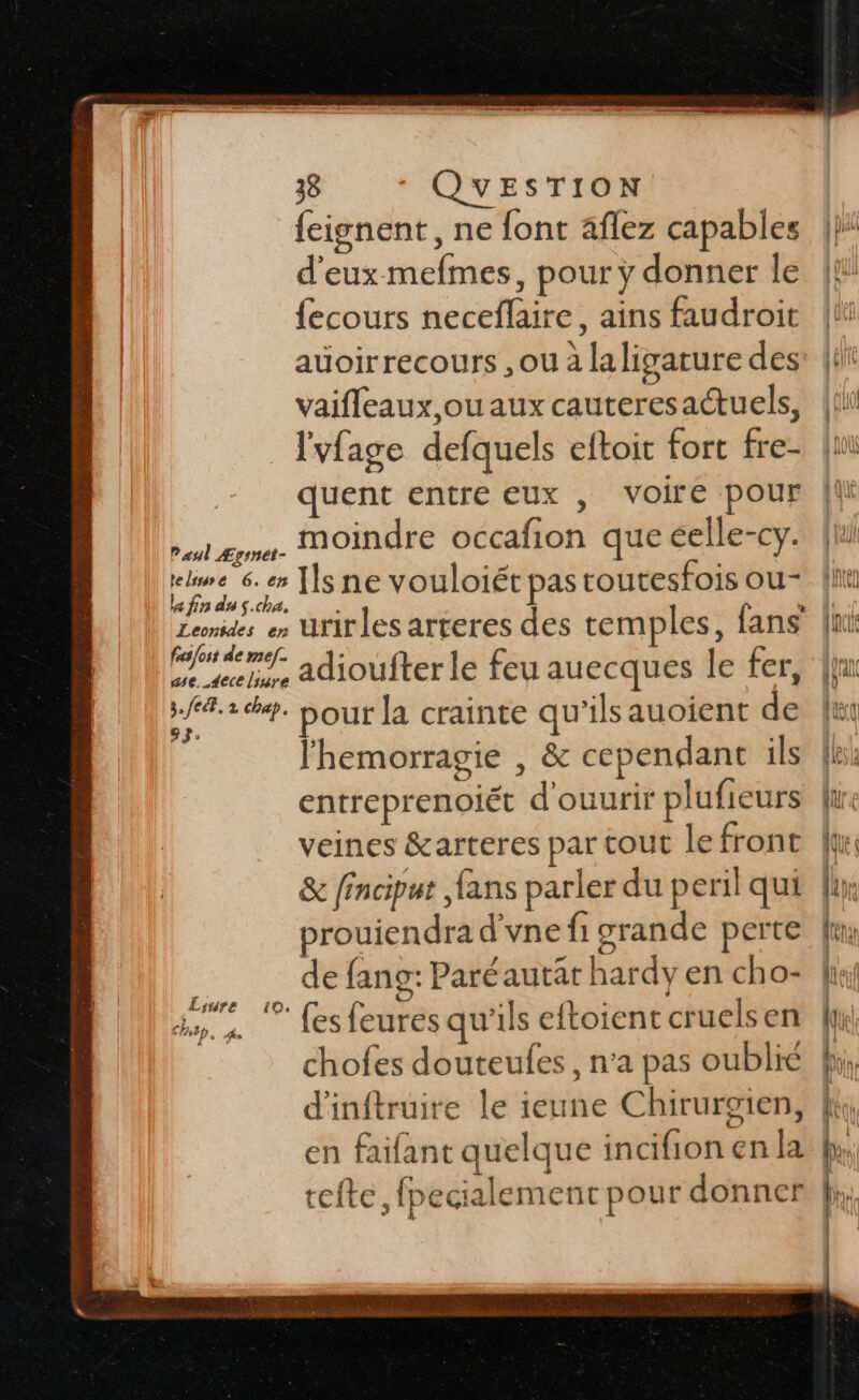 38 QUESTION {eignent, ne font aflez capables d'eux mefmes, pour ÿ donner le {ecours neceflaire, ains faudroit auoirrecours , ou à laligature des vaifleaux,ou aux cauteresactuels, lvfage defquels eftoit fort fre- quent entre Eux , voire pour ui eme. MOindre occafion que éelle-cy. elwe 6. er [][s ne vouloiét pas toutesfois ou- le fin du s.cha. fs {est de mef. Foie pour la crainte qu'ils auoient de entreprenoiét d'ouurir plufieurs veines &amp;arteres par tout le front &amp; finciput fans parler du peril qui prouiendra d'vne fi grande perte de fang: Paré autat hardy en cho- ? fes feures qu'ils eftoient cruels en chofes douteufes , n’a pas oublié d'inftruire le ieune Chirurgien, en faifant quelque incifion en Î: efte, fpecialement pour donner Lsuyre Ch UET . An | \ \\ Wan [ip