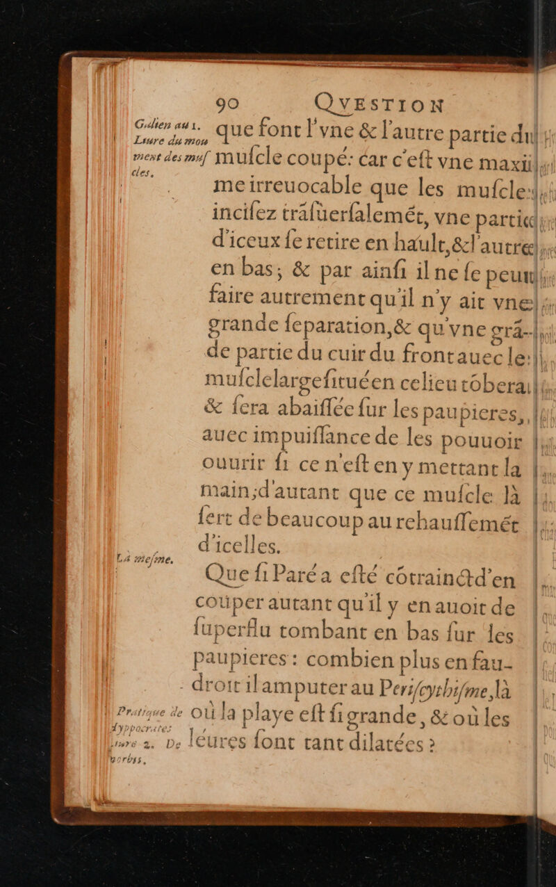 Gale «1. que font l'vne &amp; l’autre partie du Liure du mou cles, d'icelles. Que fi Paré a efté côtraintd'’en cOüper autant qu'il y enauoit de fuperflu tombant en bas fur ‘les pPaupieres : combien plus en fau- - droit ilamputer au Periysb me, là D à nËE “ fr F2 ft 8 s de R &gt; 1les L'FATIG OÙ 19 PIaye € 119ranc C, OL 1CS lyppacrates 1-7 { 1: / é isre 2 De [eures IONC tant dilatées &amp;