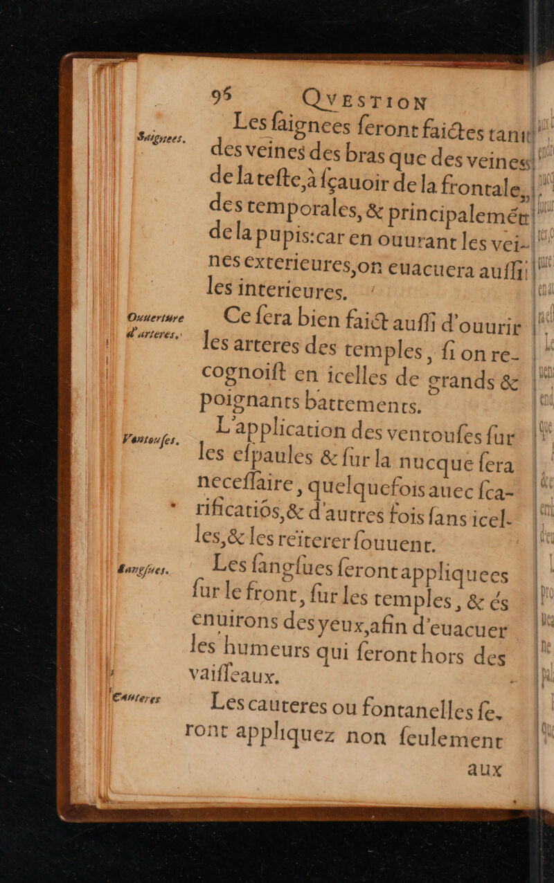 Les faignces feront faictes tant. des veines des bras que des veines” de latefte à fçauoir dela frontale, |. des tem Porales, & prin cipalemée| de la pupis:car en ouurant les vei-| nes extérieures on euacuera auff: les intérieures. Ouserwe Ce {era bien fai auf d'ouurir Free. es areerés des ten ples, fionre- cognoift en icelles de crands & poignants batremencs. | L'application des ventoufes fu ll les efpaules & fur la n ucquelera | neceflaire, quelqu cfoisauec fca= |! rificatios,& d'autres fois fans icel- les, & les reiterer fouuenc sp Les fanofues feront appliquees fur le front, fur les temples, & és Enuirons des yeux afin d'euacuer les humeurs qui feront hors des vaifleaux. | Les cauteres ou fontanelles fe. ront appliquez non feulement aux Sxignees. Ventou(es,