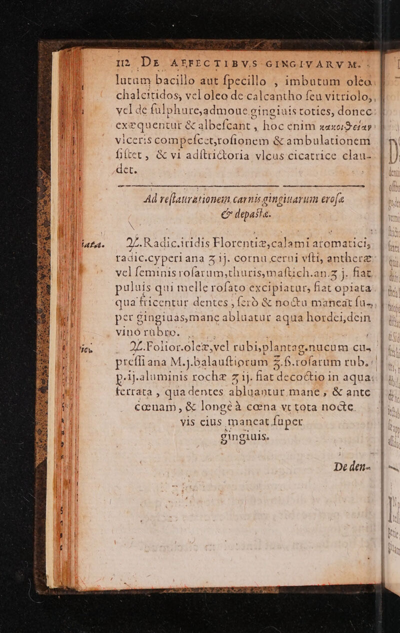 Pd € E, n? DE AEFECTIBVS GINGIVARYVM.: lutam bacillo aut fpecillo , imbutum oleo chalcitidos, veloleo de calcantho feu vitriolo, cl de fulphi 1r6,admoue.eingiuis coties, donec xequentut &amp; albefcant , A enlm oaxorSetap eris compeícctroflonem &amp; ambulationem fiic , &amp; v1 adítrictoria vlcas cicatrice clau- —— Ad re[latrationein carnis gingiuarum evo[a CP I  | | 27. Radic.iridis Florentiz;calami atomatici; radic. .Cyperiana Z 1j. cornu cerui Ms ape ra vel feminis rofarum,thuris,maftich.a j. fiat puluis qui melle rofato exeiplatgrs ac Sew qua fricentur dentes ; fzrb &amp; noctu maneat fu., pet Bingiuás,mane ablüatur aqua tog vinó rübro. 2f. Folior.olez,vel rabi;plantag g.nucum ctl, picfli ana M.j.6alauftiprum Z.f.rofarum rub. : ferrata , qua dentes abluantur.mane , &amp; antc coenam , &amp; longéà coena vt tota nocte. vis cius mancat fuper gingiuis. TA