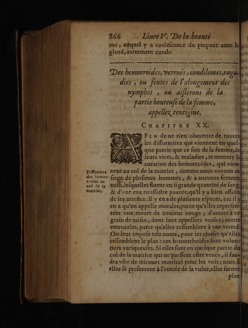 me, atiquel ÿ a coalefcence du prepuce:auec Idli:: gland, autrement curale. | 10 ent k ben Des hemorroides, verruës ; condilomes;ragasl, à dies , où fentes de l'alongement des Nc mn, © , U Le mymphes ,. 04 aiflerons de la L. partie honteufe de la femme, * kk; Maur pu Nee ( f appeller tentigine. ‘# CHAPITAE {2 re | Mince Zn F1N dene rien obmettre de toutes}, curation des hemorroides , qui vien: L. Difference nent au col de la matrice , comme nous voyons at}, . nor fiege de plufieurs hommes , & à aucunes femmes}, cot de la auili,lefquelles fluent en figrande quantité de fangil, + matrise. … & d’vne eau rouffaftre puante,qu'il ya bien affaire}, de les arrefter. Il y en a de‘plufeurs efpeces, car il y}. en a qu’on appelle morales,parce qu’elles reprefenl},.r teht vne meure de couleur rouge ; d'autres à vn}, grain de raifin, dont font appellées vuales; autresl D’ verrucales, parce qu'elles reflembient à uneverruël Onileur impofe tels noms, pour les chofes qu'elles}, reffemblent le plus :ces hemorrhoides font volons}}. tiers variqueufes, Si elles font en quelque partie dul col de la matrice qui nepuiffenc eftre veués , il faus,, dra vfer de mirouer marrical pour les voir: mais fil elles fe prefentent à l'entrée de la vulue,elles feront! dé plusi tir se ee | |
