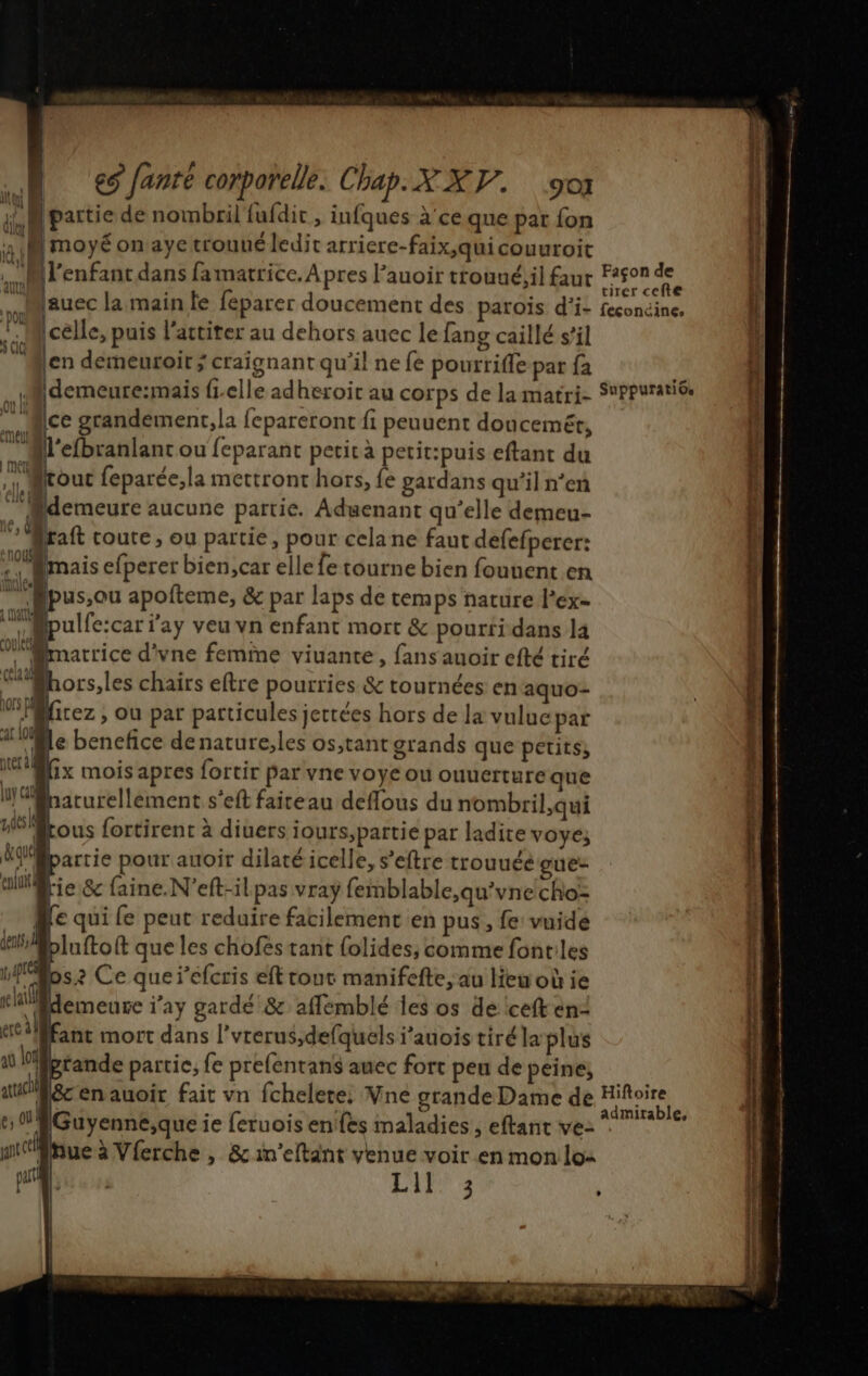 pu j | partie de nombril fufdic, infques à'ce que par fon a (| Imoyé on aye trouué ledit arriere-faix,quicouuroit . Mlenfant dans famatrice. Apres l’auoir trouné;il faut lauec la main te féparer doucement des paroïs d'i- PM celle, puis l’actiter au dehors auec le fang caillé s’il len demeuroit ; craignant qu'il ne fe pourrifle-par {a ii idemeure:mais fielle ad heroit au corps de lamatri- “ ice grandement,la fepareront fi peuuent doucemét, @l'efbranlant ou feparant petit à petit:puis eftant du PA lrout feparée;la mettront hors, fe gardans qu’il n’en … Midemeure aucune partie. Aduenant qu’elle demeu- 5 Braft coute, ou partie, pour cela ne faut defefperer: TM mais efperer bien,car elle fe tourne bien fouuent en Hé Apus,ou apofteme, & par laps de temps nature l’ex- Bpulfe:car jay veu vn enfant mort & pourri dans la MÉinarrice d'vne femine viuante, fans auoir efté tiré CE rs, les chairs eftre pourries & tournées en aquo- WBfirez , ou par particules jettées hors de la vulucpar al kt le benefice denature;les os,tant grands que petits, WAix moisapres fortir par vne voye où ouuerture que MB arurellement s'eft faireau deflous du nombril,qui pis lé h tous fortirent à diuers iours;pattie par ladite voye; aquel bartie pour auoir dilaté icelle, s’eftre trouuéé gue- epLuxt4 lie & faine.N’eft-il pas vray femblable,qu'vne cho: Me qui {e peut reduire facilement en pus , fe vuidé ja fto ft que les chofes tant folides, comme fontiles 1,916 os: Ce que r'éfcris eft tour manifefte,;au Hemobie tHMemeure i’ay gardé & affemblé les os de iceft en: “#fant mort dans l'vrerus,defquels i’auois tiré la plus 11 Mfprande partic, fe prefentans auec fort peu de peine, a f&c en auoir fait vn fchelete: VMne grande Dame de e, ob Guyenne,que ie feruois en fes maladies , eftant ve: mue à Vferche , &in’eltant venue voir en mon lo: part Lil 3 Façon de tirer cefte féconcine. Suppuratio. Hiftoire admirable,