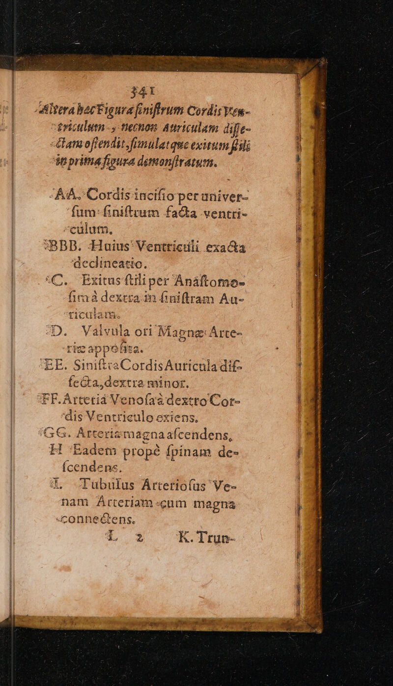 πὰς caet 341 Altera bacFigura fniffrum CordisVes- ericulum ., tecnon. Atiriculem dife- -damoftendit.fimulatque exitum fli in pritha fiyura detmonfiratum. AA. Cordis incifio per aniver- fum: f£niftrum facta ventti- -culutn, SBBDB. Huius'Ventticuli exacta declineatic. | «C. Exitus ftiliper Anáftomoe- ποτὰ dextsain finiftram Au- ticatam. 4D. Vaivula ori Maeng: Arte- riz appéfira. i qEE. Sinitta CordisAuricnla dif ÍcGta, dextra minor. FF.Artetiá Venofaaà dextro Cor- dis Ventriculo exiens, GG. Arterizmagnaafcendens, ΕἸ 'Eadem prop fpinam de- íÍcendens, X. Tubulus Árterio(üs Ve- nam Arteriam-cum magna «4connectens. T L $ K. Trun-