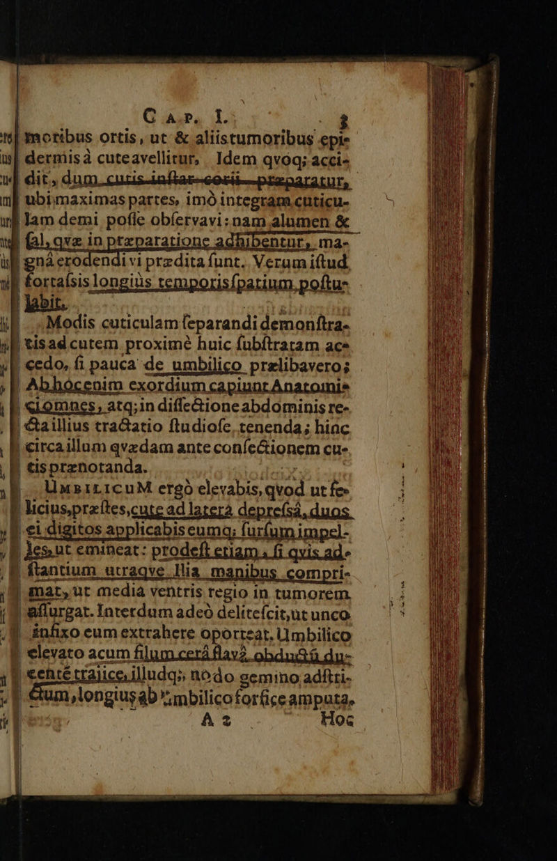                      | G sp. il. $ 1| moribus ortis, ut &amp; aliistumoribus epie i| dermis cuteavellitur, Idem qvoa; acci- wl dit, dum. cuzis-iafiac-cosii-- przparatur, iri] ubimaximas partes, imó integram cuticu- n Jam demi pofle obíervavi;nam alumen &amp; -  uli gná erodendi v1 przdita funt. Verum iftud, nia fortaísis longius temporisfparium. ,poftu- | labir. lE. . Modis cuticulam (cparandi demonflra- 2B tisad cutem proximé huic fubítratam ace y E «edo, fi pauca de umbilico prelibaveros - ; | Abhocenim exordium capiunrAnatoinie | B «1omnss, atq;in diffe&amp;ioneabdominis re- | &amp;aillius tra&amp;atio fludiofe, tenenda; hiac | circaillum qvzdam ante coníc&amp;ionem cu- | tisprznotanda. | ümw»iLICuM ergó Clevabue qvod ut fe: 3 | licius,praftes,curc ad latera depreísi duos. | .€i digitos applicabis eumq; furfum impz]- , B Aes.nt emineat: prodeft etiam. fi qxis.ad- , B ftantium utraqve. ]lia m manibus .compri- | mat,ut media ventris regio in tumorem. T (m affurgat. Interdum ade delitefcitut unco — ^ ;8 infxo eum extrahere oporteat, Umbilico | elevato acum filum cerá flav2. obdudiü.dnu- '€ehté trajice illudq; nodo semino adfiti- , &amp;um longius ab .mbilico forfice amputa, A3 Hoc     1 - x A  -—-— 8 *  E ERA cement La ru