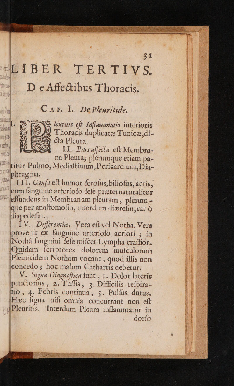 3i LIBER TOER' TIUS |! DeAfed&amp;ibus Thoracis. 3 PASS lenis eft Inflammatio interioris i3 [5 y, Thoracis duplicate Tunicz,di- (f ROS Ga Pleura. XM NSNGS) II. Parsajffecta eft Membra- na Pleura; plerumque etiam pa- AA iphragma. ] III. Caufa eft humor ferofüs,biliofüs, acris, Icum fanguine arteriofo fefe preeternaturaliter leffundens in Membranam pleuram , plerum - ique per anaftomofin, interdum dizrefin,rar à Hiapedefin. | IV. Diferentie. Vera eft vel Notha. Vera |provenit ex fanguine arteriofo acriori ; in INothà fanguini fefe mifcet Lympha craffior. IQuidam ícriptores dolorem mufculorum IPleuritidem Notham vocant , quod illis non ieoncedo ; hoc malum Catharris debetur. | V. Szgna Diagnoflica funt , x. Dolor lateris jpunctorius , 2. Tuffis, 5. Difficilis refpira- (tio, 4. Febris continua, $. Pulíus durus. Hzc figna nifi omnia concurrant non eft IPleuritis. Interdum Pleura inflammatur in dorío