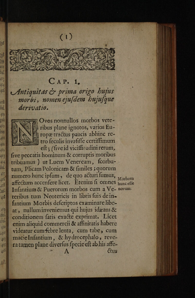 | jántiquitas c prima origo bufus |- moréi, nomen eju[dem bujufque derrvatio. zx Ovos nonnullos imorbos vete- x3 3 El ribus plane ignotos; varios Eu- IS| ropa tractus paucis abhinc re- | tro feculis invafiffe certiffümum | eft ; (fiveid viciffitudini rerum, | five pecc atis hominum &amp; corruptis moribus tribuamus ) ue Luem Veneream, fcorbu- 'J tum, Plicam Polonicam &amp; fimiles ; quorum B numero huncipfüm, dequo acturi fumus, | affectum accenfere licet. Etenim fi omnes n ifa | Infantium &amp; Puerorum morbos cum a Ve- novum. | teribus tum Neotericis in libris futs dein- | fantium Morbis defcriptos examinare libe- | at, nulluminveniemus qui hujus ideam &amp; M conditionem fatis exacte exprimat. Licet ,R enim aliquid commercii &amp; affinitatis habere | videatur cumfebre lenta, cum tabe, cum 38 macielnfantum, &amp; hydrocephalo, reve- | ratamen plane diverfus fpecie eft ab his affe- ni 4k ctus