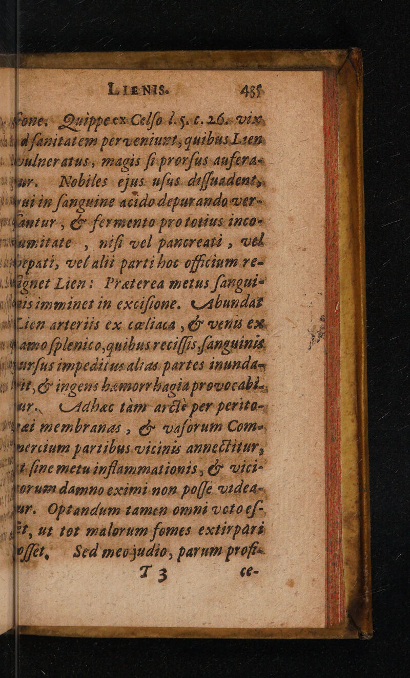 LizWis. 4$5t. y aane Quippeex Celfo d.got. 265 io, alpafanitatem perweniuzt; quibus.Lien. Mur. Nobiles ejus: ufus. diffuadenty. Mud in fanguine acido depurando ver. vlamrur- eo fermento prototius 1nco« sWemitate , nifi vel pancreas , «uel Alptpat?, vel alii parti hoc officium ve- donet Lien: Preterea metus faugmt Mazs zeyamdnet i excifrone. «abundaz MlLzezz avteriis ex cmliaca qr vena e. erdum partibus vicium annecittur, fene mezuánflammationis, € vvici- iorum damno eximinon. po[[e utdeA-. Mur. Optandum tamen omni voto ef- «dei, ut tot malorum fomes extirpars | //et, Sed mevjudio, barum profts. | T ce-