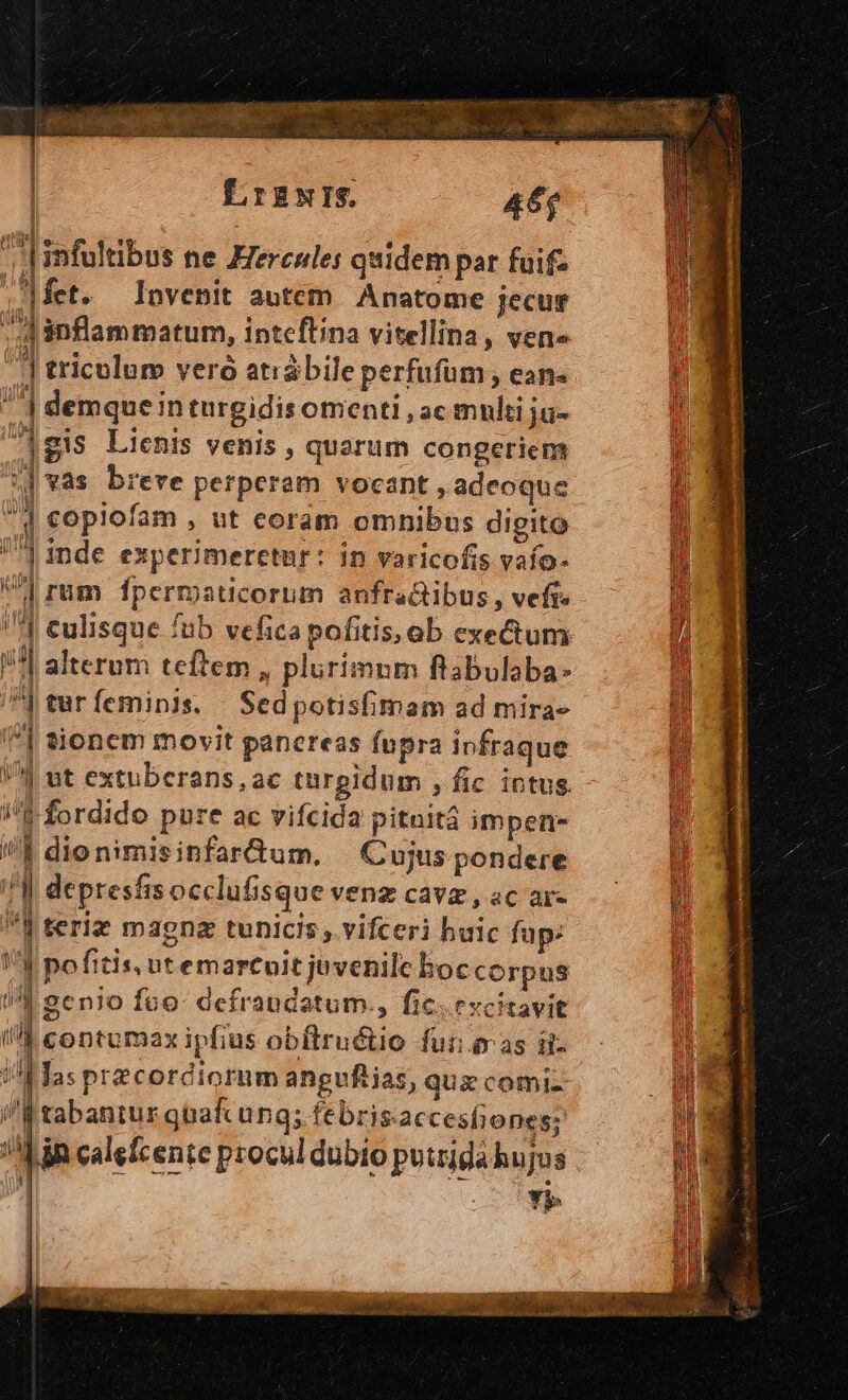 | LrBNIS — —— a6 | T 3d e ec 9 * - Ainfultibus ne Eercsles quidem par fuif- ;.|fet. Invenit autem Anatome jecur ] inflammatum, intcftina vitellina, ven» l tricolum vero atrábile perfufüm , ean- ^| AH 7| demque in turgidis omenti , ac multi ju- | 3 gis Lienis venis , quarum congeriem ij vas breve perperam vocant , adeoque  | copiofam , ut coram omnibus digito ]inde experimeretur: ín varicofis vafo- ji V] rum fpermaticorum anfractibus, vefi» i /1 culisque fub vefica pofitis, ob exectum  !| alterum teftem , plurimnm ftabulaba- /J turfeminis. Sedpotisfimam ad mira- I] sionem movit pancreas fupra infraque | 4 ut extuberans,ac türgidum , fic ictus pU iJ fordido pure ac vifcida pitnitá impen W !J dio nimisinfar&amp;um. Cujus pondere f| depresfisocclufisquevenz cave, scare .—— || j teriz magna tunicis , vifceri buic fap:  d pofitis, ut emarcoit juvenile boc corpus lí (A'eenio fuo: defrandatum., fic.escitavit i4 contumax ipfius obitruétio fur eras ii- iATas przcordiorum angufiias, qux comi- /'Ftabantur gqtafc ung; febris.accesfiones; ' Min calefcente procul dubio putrida hujus | Y