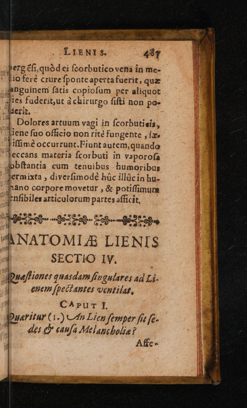 | Jergéfi,quód ei fcorbntico vená in me- lio fere crurefponte aperta fuerit, que ,gRUguinem fatis copiofum per aliquot sies faderit,ut d chirurgo fifti non pe. m derit, ; : u B , 4j, Dolores artuum vagi in fcorbutieis, | ^ Mene fuo officio non rite fupgente , íz» we JMffim? occurruntc.Fiunt autem,quando n eccans materia fcorbuti in vaporofa » dbbftantia cum tenuibus humoribus jj Nermixta , diverfimodé hüc illácin hu- Wh nano corpore movetur , &amp; potiffimuns E e nfibiles articulorum partes afficit, » bairM--0009-19--Mi — | NATOMIZS LIENIS j v SECTIO IV.   / 1  f nii DuefPiones quasdam ffogulares ad Li- | enm fpeciantes ventilat, | CA»ur I. ! 2 Duaritur (1-) Con Lien femper fit je We ] — 4e d eanfa Melancholia? B ] Affe ' Í » | I T Wn
