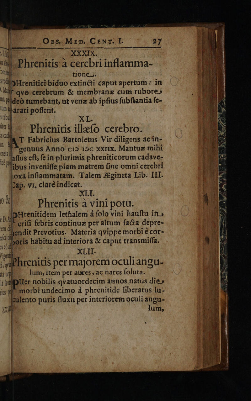 XL. Phrenitis illefo cerebro. T Fabricius Bartoletus Vir diligens acin- genuus Anno c15 15c xxrix, Mantuz mihi : affus eft; fe in plurimis phreniticorum cadave- libus inveniffe piam matrem fine omni cerebri lioxa inflammatam. Talem Zegineta Lib. III. |Zap. vr, clare indicat. xL | Phrenitis à vini potu. IpHrenitidem lethalem à folo vini hauftu in; I* crifi febris continuz per altum fa&a depre- -endit Prevotius. Materia qvippe morbi é cor- Doris habitu ad interiora & caput transmiffa. ! XLII- i ahrenitis per majorem oculi angu- t vil lum, item per auxes , ac nares foluta. morbi undecimo à phrenitide liberatus lu- kulento puris fluxu per interiorem oculi angu- P. Ium;