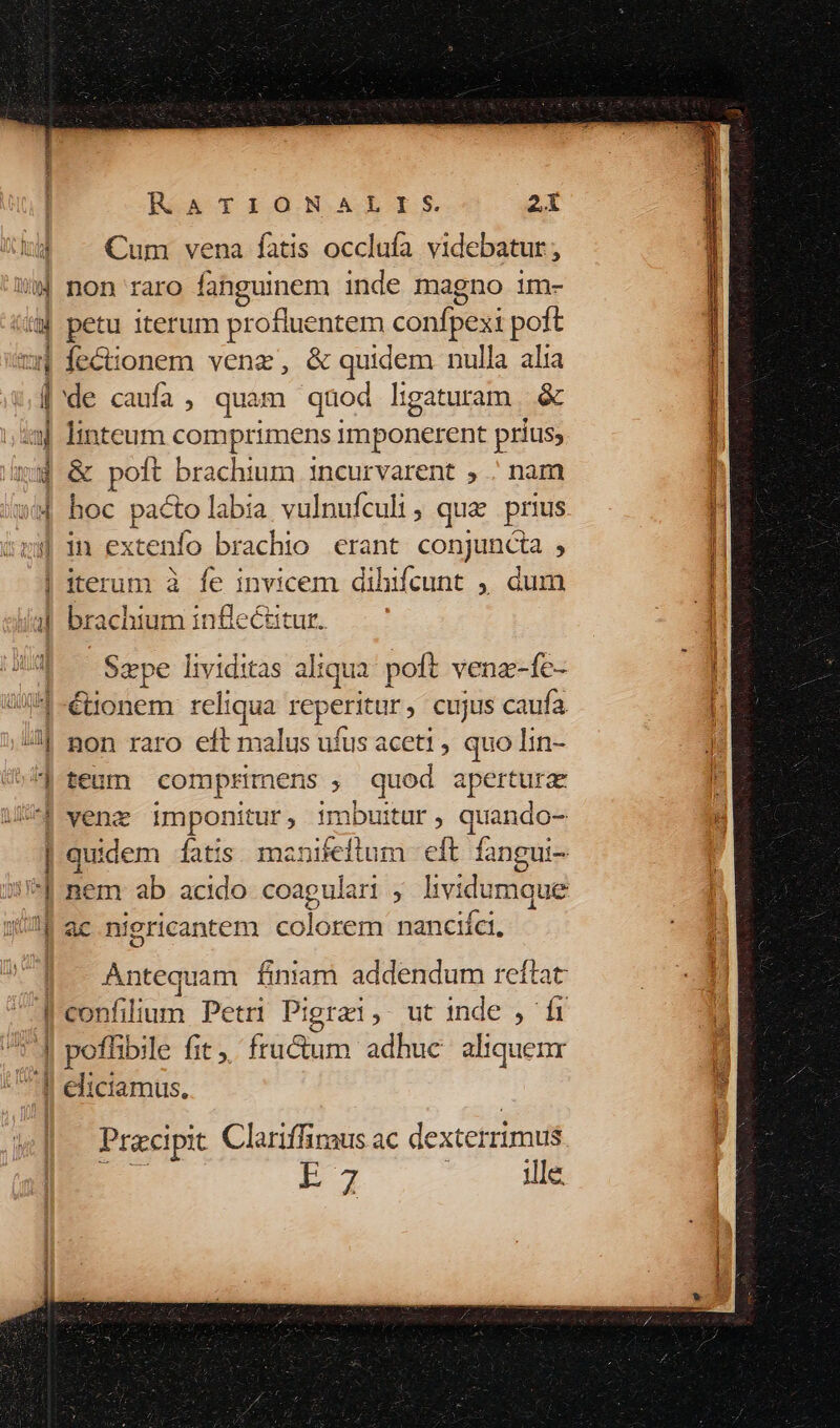 Nec aS um vena fatis occlufa videbatur, non raro fahngumem inde magno im- petu iterum profluentem confpext poft fectionem venz, &amp; quidem nulla alia de caufa, quam qaod ligaturam.. &amp; linteum comprimens imponerent prius; &amp; poft brachium incurvarent , . nam hoc pacto labia vulnufculi , qua prius iterum à fe invicem dihifcunt ,, dum brachium inflecitur. Sxpe lividitas aliqua: poft. vena-fe- €tonem reliqua rep ritur, cujus caufa non raro eft dures ufus aceti , quo lin- teum comprimens 3 quod apertura venz imponitur, imbuitur, quando- nem ab acido coagulari , lividumque ac niericantem colorem nanciíci. Antequam Énam addendum reftat confilium Petri Pigrai, ut inc de, fi pofbile fit, fructum adhuc aliquenr Pracipit Clariffiraus ac dextetul rimus 1:7 : ille