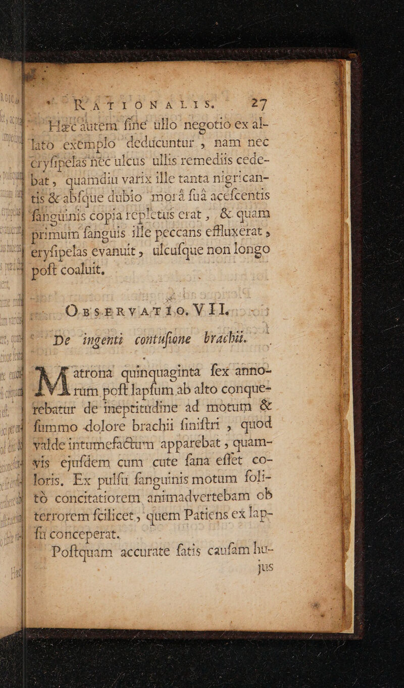 $3f20$:34 dU LA ERA $- sl11- A^ Gc- 1 Qe S-— 1 le tanta AC tail ci OssbERVvVATÍIO.VIL i. fex anno- * aginta contufiene brach ingenti . atrona I1 Tu im ab alto co: 1 Lf 1 I inq ít qu ft que- ne àd motum &amp; di apti tu s ! * A n po e mept | rebatur d P ar te fana eff: ^5 € CU 11 ^ Aac clu uam : 1t s ejuídem c ldei: yal 13 2M v9 ebat ; quam- t co- fl C smotum 1i 4 i Cu un * 4 iP[e A * 4 Hiiu fan C tC 451 ii 14 li ei [e) Lil P ertebam : £CLAÀ2 x b 4^ be inimadv , daem Pa ^ e em 5 t4 1^ ta Iii tó conci ns e : 1C T is Ut E [| Ícilice f£ erat. ^ D cc I on fuc j x Poftquam accurate fatis