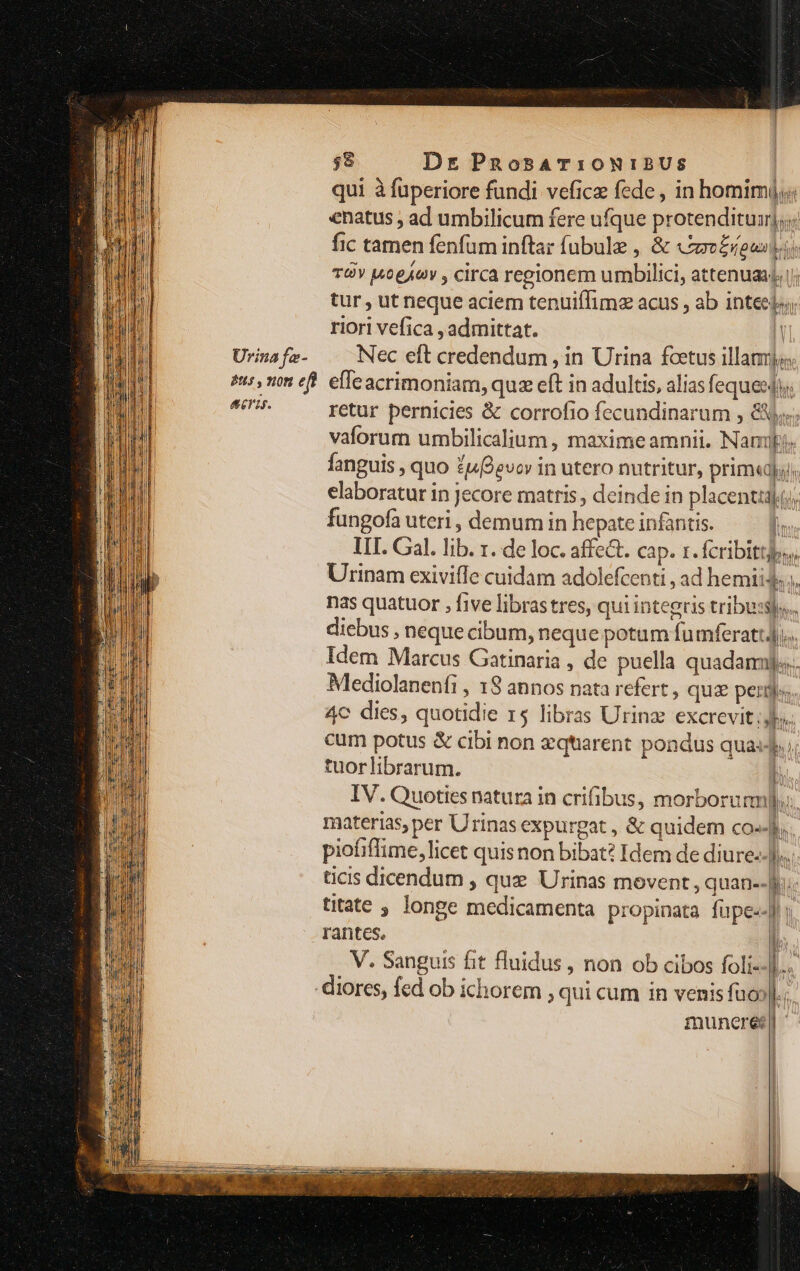 t5 , 0n eff E15. $$ Dr PRosAT:0NIBUS | qui à fuperiore fundi vefice fede , in homimi;; natus , ad umbilicum fere ufque protenditur]; fic tamen fenfum inftar fubule , &amp; «se£reesi TÓYV 14060 , CITCA regionem umbilici, attenuaaj i; tur , ut neque aciem tenuiíTime acus , ab inteejus riori vefica , admittat. | effeacrimoniam, quz eft in adultis, alias fequesdi. retur pernicies &amp; corrofio fecundinarum , &amp;X.; vaforum umbilicalium , maximeamnii. Nampi« fanguis , quo £u9evov in utero nutritur, primu). elaboratur in jecore matris , deinde in placenttdki, fungofa uteri , demum in hepate infantis. l LUI. Cal. lib. 1. de loc. affe&amp;. cap. x. fcribit, Urinam exiviffe cuidam adolefcenti , ad hemii4, nas quatuor , five librastres, qui integris tribu:sls... 1 11 Ris) diebus , neque cibum, neque potum fumferatt4. Idem Marcus Gatinaria , de puella quadamijjs.. Mediolanenfi , 18 annos nata refert, quz pergis, 4C dies, quotidie 15 libras Urinz excrevit Jes. cum potus &amp; cibi non zqtarent pondus quas... tuorlibrarum. [ IV. Quoties natura in crifibus, morborum: materias, per Urinas expurgat , &amp; quidem co-4. piotiffime, licet quisnon bibat? Idem de diure-.]... ticis dicendum , que Urinas movent , quan--]..- titate ; longe medicamenta propinata füupe--]: V. Sanguis fit fluidus , non ob cibos foli- inuncréec l.i |  l ! l | l | l ]