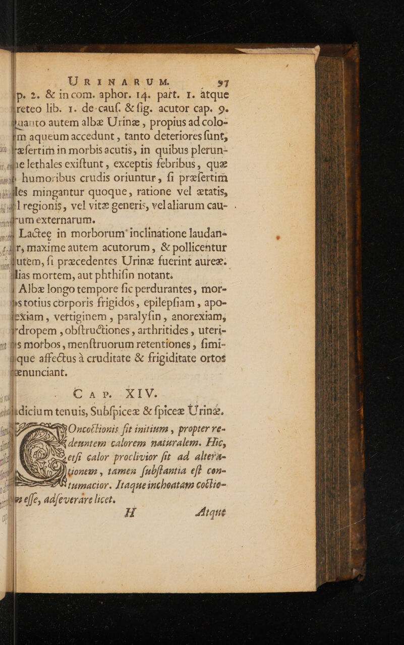 lp. 2. &amp; incom. aphor. 14. part. r. atque [reteo lib. 1. de-cauf. &amp; fig. acutor cap. 9. jluanto autem albe Urinz , propius ad colo- jm aqueum: accedunt , tanto deteriores funt, i eeefertirn in munpbisicn ri in quibus plerun- ; ae lethales exiftunt , exceptis febribus, que ib. humoribus uds oriuntur , fi przfertim udis mingantur quoque , ratione vel etatis, dil regionis, vel vitz generis, velaliarum cau- d um externarum. ,/ La&amp;ee in morborum inclinatione laudan- ;. Jr, ntaxime autem acutorum , &amp; pollicentur , utem, ft precedentes Urinz fuerint aurez. JMias mortem, aut phthifin notant. | Albe longo tempore fic perdurantes, mor- jstotius corporis frigidos, epilepfiam , apo- IeXiam , vertiginem , paralyfin , anorexiam; Irdropem , obftructiones , arthritides , uteri- 4 Bls morbos , menftruorum retentiones , fimi- $fique affectus à cruditate &amp; frigiditate ortos &amp;enunciant. | C X ESVXIV. dillidicium tenuis, Subfpicez &amp; fpicez Uring. gens Oncotlionis [it initium , propter ve- AM denatem calorem naiuralem. Hic, etfi. calor proclivior ftt ad. altera- Uontas , tamen fubflantia ef? con- B tumacior. Itaqueinchoatam cottio- dz effe, ad/everare licet. Atque