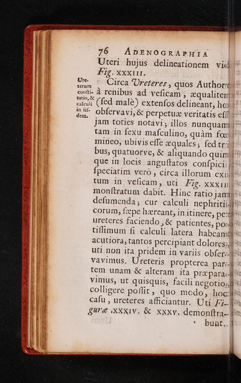 ;] ? SN I ALPAMLEUE HB Sos MS Ure- dem, 76 ApnENOGRAPHIA | Uter hujus delineationem | vid £27. Xxxi11. Circa 'Ürezeres , quos Author &amp; obfervavi, &amp; perpetux veritatis efi] jam toties notavi; illos nunquamqj tam in fexu mafculino, quàm foc mineo, ubivis effe zquales; fed trij bus, quatuorve, &amp; aliquando quim] que 1n locis angufítatos confpicii [f^ Ípeciatim veró , circa illorum exiit tum in veficam, uti Fg. xxxn monítratum dabit. Hinc ratio Jamiy' : defumenda; cur calculi nephriciiJf tiffimum fi calculi latera habeamdt'i acutiora, tantos percipiant dolores; pu uti non ita pridem in variis obfer:- 4: vavimus. Ureteris propterea par:JP tem unam &amp; alteram ita prazparaJi vimus, ut quisquis, facili negotio colligere poffit , quo modo, hoc cafu , ureteres afficiantur. Uti Fm 9€ XXXIV. &amp; XXxv. demonftra.. Bs * bunt.