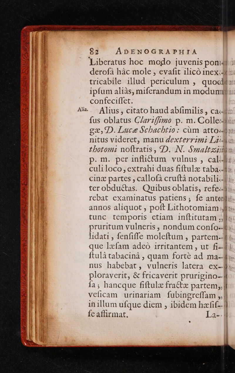 3 5f MEA Pato. ad 15. Ue XR DA HERANSIE JB ex 2. 107228 0 DA 82 ÁDENOGRAPHIA Liberatus hoc modo juvenis pon: derofà hác mole , evafit 1licó inex:Ji i: tricabile illud periculum , quodi a: ipfum aliàs, miferandum in modumilj confeciflet. Alius , citato haud abfimilis , ca.3: fus oblatus C/zrz///mio p. m. Colle: 225, D. Luce Schacbtzo : cüm atto: nitus videret, manu dexterrzmi Lz-Ao Zbotomi noftratis , «D. N. Smaltzis p. m. per inflictum. vulnus , caldi: culiloco, extrahi duas fiftulzx taba. cinz partes , callofà cruftà norinE  ter obduc&amp;tas. Quibus oblatis, refe.- rebat examinatus patiens; fe antec annos aliquot , poft Lithotomiam; E tunc temporis ctiam inftitutam ,, [.. pruritum vulneris , nondum confo.-l lidati , fenfiffe niolcitamb partem-.f à. que Ixfam adeo irritantem , ut fifi ftulà tabacinà , quam forte àd ma--lo nus habebirtn vulneris latera exl. ploraverit, &amp; fricaverit prurigino--]f fa ; hancque fiftulz fra&amp;x partem, |l ESncam urinariam | fubingreffam ,, it illum ufque diem ; ibidem hacfif-. | fe affirmat. La-. d