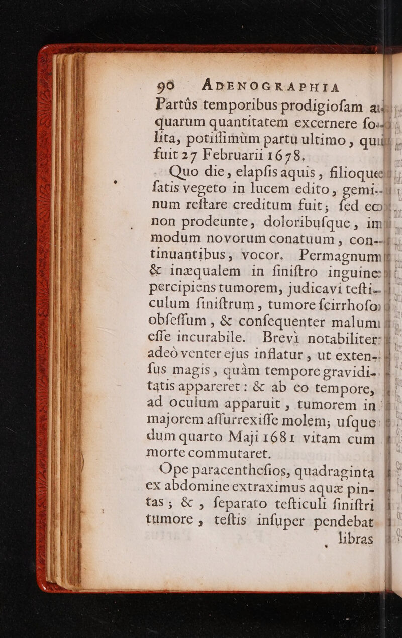 :] Jib MM ICONGN d TSVHRATIN ree xU IM AU às k ES ad 2 90 ÁDENOGRAPHIA lita, potiifimüm partu ultimo , quii fuit 27 Februarii 1678, Quo die, elapfis aquis , filioque fatis vegeto in lucem edito, gemlt.- num reftare creditum fuit; fed eo non prodeunte, doloribufque, im &amp; inzqualem in finiftro. inguine:| efle incurabile. Brevi notabiliter: tatis appareret : &amp; ab eo tempore, ad oculum apparuit , tumorem in: majorem affurrexiffe molem; ufque dum quarto Maji 1681 vitam cum morte commutaret, Ope paracenthefios, quadraginta €x abdomine extraximus aqux pin- tas; &amp; , feparato tefticuli finiftri tumore , teftis infuper pendebat . libras ' | ' LÀ — iab. OT a m^ -— -— si -