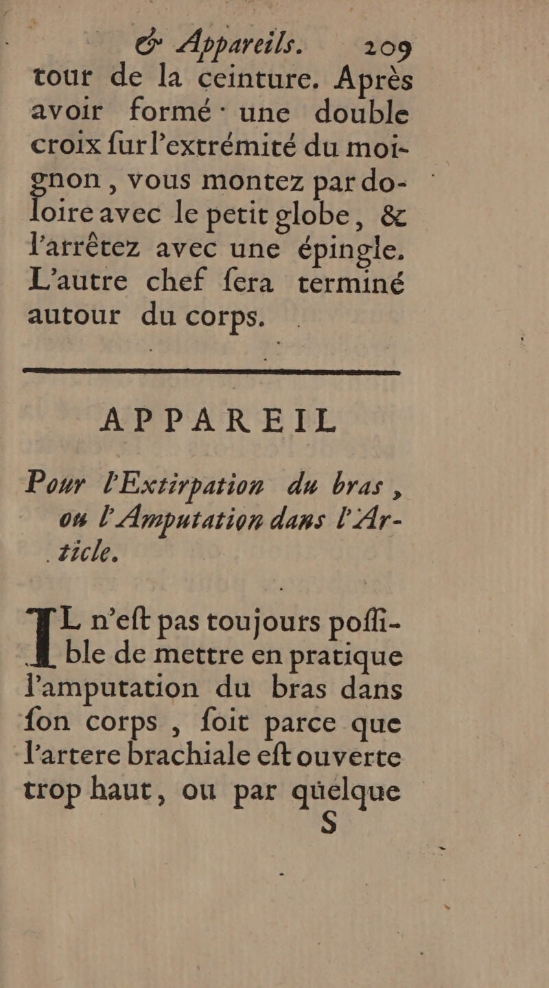 tour de la ceinture. Après avoir formé: une double croix fur l'extrémité du moi- gron , Vous montez par do- oire avec le petitglobe, &amp; l'arrêtez avec une épingle, L'autre chef fera terminé autour du corps. . APR ORTR EE Pour l'Extirpation du bras, on l'Amputation dans l'Ar- _ticle. T: n’eft pas toujours pofli- 4 ble de mettre en pratique lPamputation du bras dans fon corps , foit parce que l’artere brachiale eft ouverte trop haut, ou par At