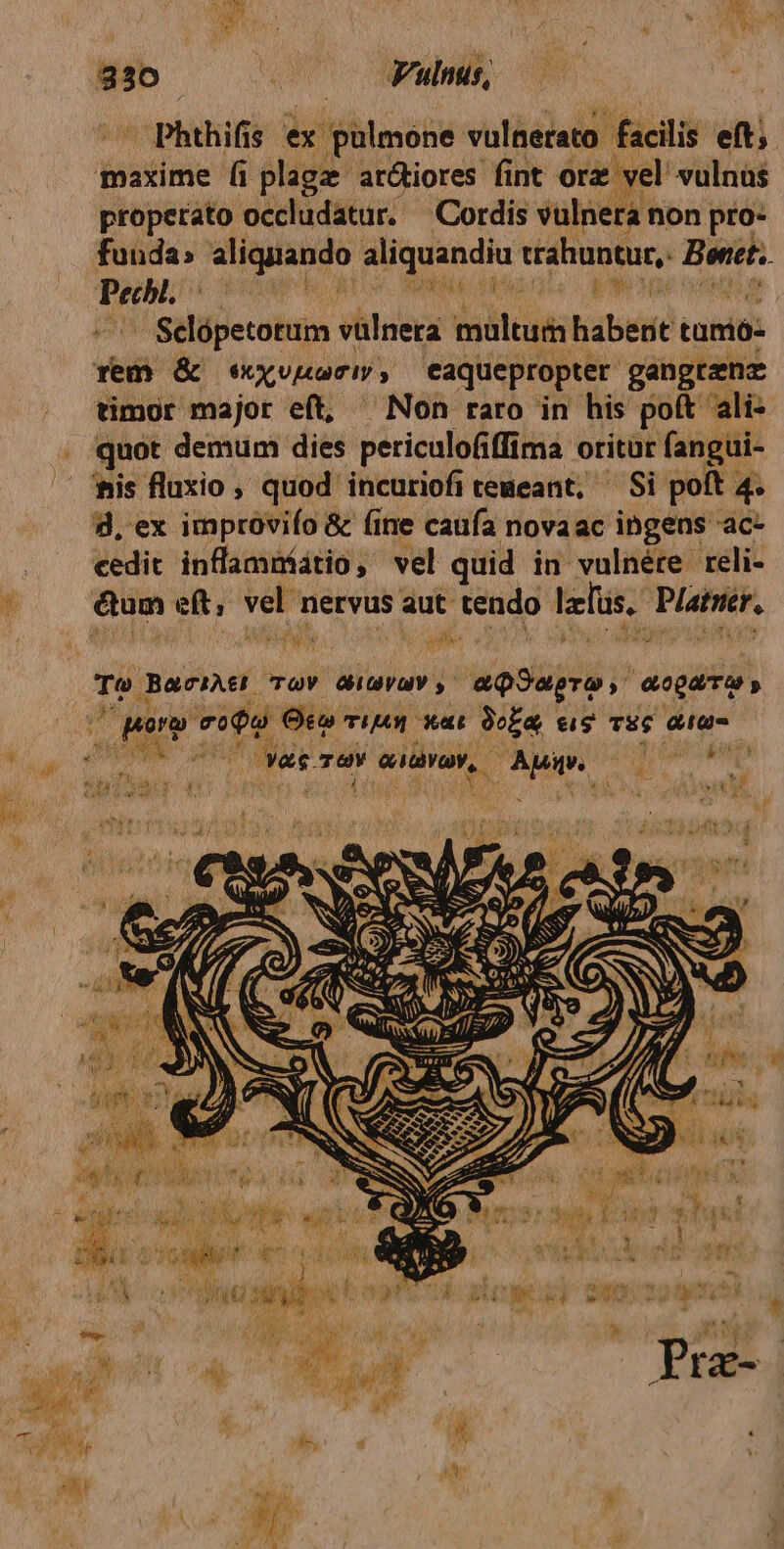 330 —— — Fulnus, -Phthifis ex ir iphimons vulnerato facili eft; maxime (i plagz ar&amp;iores fint orz vel' vulnus properato occludatur. Cordis vulnera non pro- funda; aliquando aliquandiu trahuntur,: Bin Pecbi. MM UC NEOPENA Ua ANM ^ Selpetotuim vülnera multum habent tamióz rem &amp; eX ami eaquepropter. gangrenz timor major eft, ^ Non raro in his poft ali- quot demum dies periculofifftma o oritur fangui- fis fluxio ,' quod incuriofitemeant, ^ Si poft 4. d, ex improviío &amp; fine caufa novaac ingens ac- cedit inflamníátio, vel quid in vulnére reli- &amp;um eft, dne nervus aut. tendo falus, PUE fü ad No iom [ETT