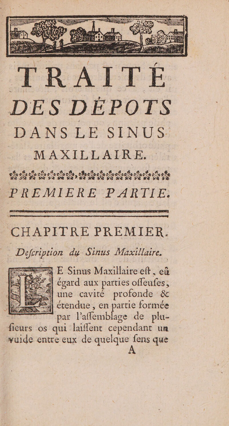 DES DÉPOTS DANS-LE SINUS: no MOSS Partners et teens CHAPITRE PREMIER. Defériprion dy Sinus Maxillaire. | = E Sinus Maxillaire ef: ed ce ÿ | égard aux parties — MA une cavité profonde &amp; | rendue, en partie formée | par l'affémblage de plu- fieurs os qui laflent cependant un vuide entre eux de quelque pe que