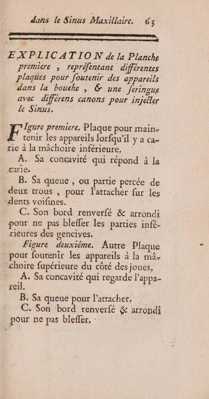 EXPLICATION de la Planche _ premiere , repréfentant différentes plaques pour foutenir des appareils dans la bouche , &amp; une Jeringue avec differens canons Pour injecter de Sinus. : _ T'lgure premiere, Plaque pour main- F terur les appareils lorfqu'il y a ca- xie à la mâchoire inférieure, À. Sa concavité qui répond à Ja carie. “e B. Sa queue , ou partie percée de -deux trous , pour l'atracher fur les dents voifines. C. Son bord renverfé &amp; arrondi pour ne pas bleffer les parties infé- rieures des gencives. | Figure deuxiéme, Autre Plaque * pour fourenir les appareils à a mà. choire fupérieure du côté des joues, À. Sa concavité qui regarde l’appa- æeil. _ B. Sa queue pour l’atracher, C. Son bord renverfé &amp; arrondi pour ne pas bleffer. :