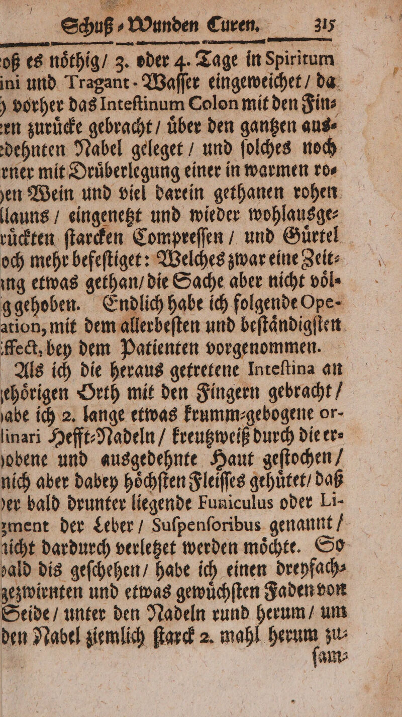 oß es noͤthig / 3. oder 4. Tage in Spiritum ini und Tragant Waſſer eingeweichet / da vorher das Inteſtinum Colon mit den Fin⸗ en zuruͤcke gebracht / über den gantzen aus⸗ dehnten Nabel geleget / und ſolches noch ener mit Druͤberlegung einer in warmen ro⸗ ven Wein und viel darein gethanen rohen llauns / eingenetzt und wieder wohlausge⸗ rückten ſtarcken Compreſſen / und Gürtel och mehr befeſtiget: Welches zwar eine Zeit⸗ ing etwas gethan / die Sache aber nicht voͤl⸗ g gehoben. Endlich habe ich folgende Ope- ation, mit dem allerbeſten und beſtaͤndigſten ffect, bey dem Patienten vorgenommen. Als ich die heraus getretene Inteſtina an ehoͤrigen Orth mit den Fingern gebracht / habe ich 2. lange etwas krumm⸗gebogene or- linari Hefft⸗Nadeln / kreutzweiß durch die er⸗ jobene und ausgedehnte Haut geſtochen / nich aber dabey hoͤchſten Fleiſſes gehuͤtet / daß her bald drunter liegende Funiculus oder Li. zment der Leber / Sufpenforibus genannt / licht dardurch verletzet werden moͤchte. So sald dis geſchehen / habe ich einen dreyfach⸗ zezwirnten und etwas gewuͤchſten Faden von Seide / unter den Nadeln rund herum / um den Nabel ziemlich ſtarck 2. mahl n zu⸗ | am⸗
