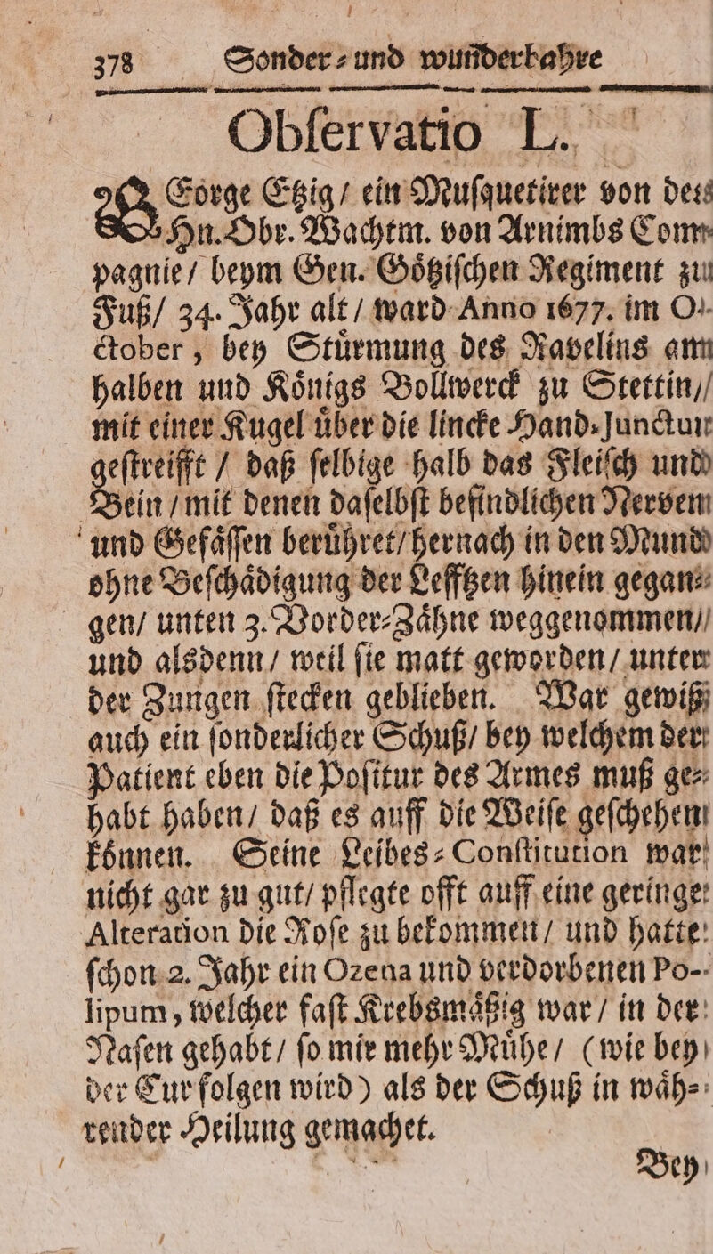 Obfervatio L. AS Etzig / ein Muſquetirer von des: Hn. Obr. Wachtm. von Arnimbs Com. pagnie / beym Gen. Goͤtziſchen Regiment zu Fuß / 34. Jahr alt / ward Anno 1677. im O.. ctober, bey Stuͤrmung des Ravelins am halben und Koͤnigs Bollwerck zu Stettin / mit einer Kugel uͤber die lincke Hand⸗Junctun geſtreifft / daß felbige halb das Fleiſch und) Bein / mit denen daſelbſt befindlichen Nerven und Gefaͤſſen beruͤhret / hernach in den Munde ohne Beſchaͤdigung der Lefftzen hinein gegan⸗ gen / unten 3. Vorder⸗Zaͤhne weggenommen / und alsdenn / weil fie matt geworden / unter der Zungen ſtecken geblieben. War gewiß auch ein ſonderlicher Schuß / bey welchem der Patient eben die Poſitur des Armes muß ge⸗ habt haben / daß es auff die Weiſe geſchehen konnen. Seine Leibes⸗Conſtitution war nicht gar zu gut / pflegte offt auff eine geringe: Alteration die Hofe zu bekommen / und hatte ſchon 2. Jahr ein Ozena und verdorbenen Po- lipum, welcher faſt Krebsmaͤßig war / in der Naſen gehabt / ſo mir mehr Muͤhe / (wie bey der Cur folgen wird) als der Schuß in waͤh⸗ render Heilung gemachet. ö | . e Bey