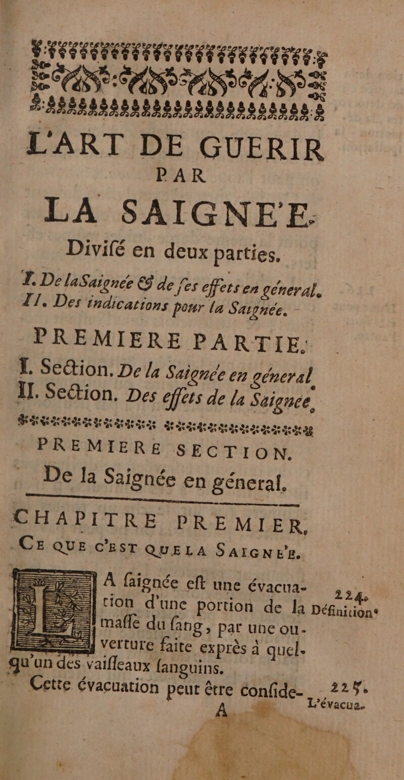 HRALOLCES LEP ETS É TT ÉT EL a COTE AS SARASSSARDBRSS ESS sans L'ART DE GUERIR | PAR LA SAIGNE'E. Divifé en deux parties. T. De laSaignée € de fes effets en general, T1. Des indications pour la Sargnee. - PREMIERE PARTIE: TL Setion. De /4 Saignée en géneral IT. Setion, Des effets de la Saignce, J y] J e « Parade ROLE RE EEE TOUR PREMIERE SECTION. De la Saignée en géneral. CHAPITRE PREMIER, -CE QUE C'EST QUELA SAIGN EL. =] À faignée cft une Évacua- ,, : tion d’une portion de la Définirion® 1 mafle du (ang, par une ou. j verture faite exprès à quel. qu'un des vaifleaux fanguins. pS)) El j #1 (in ] pl ï Qu te 6 in! nr À = L 22 ÿ, … Cette évacuation peut être confide Cr DR