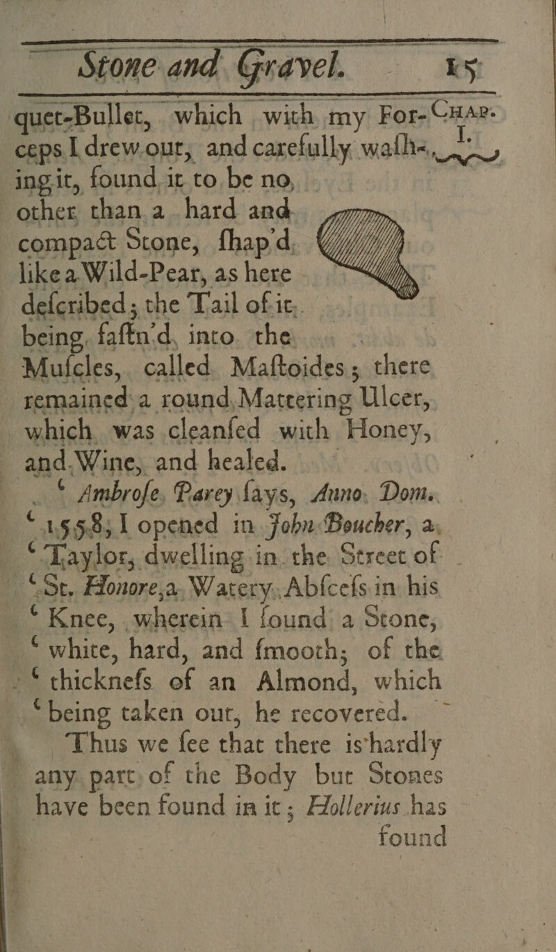 ingit, found it to be no, other, than.a_ hard and compact Stone, fhap'd. like a Wild-Pear, as here defcribed; the Tail of ic,. being, faftn:d, into. the Mulcles, called Maftoides; there remained: a round, Mateering Ulcer, which, was cleanfed with Honey, and.Wine, and healed. - . _ . * Ambrofe, Parey fays, Anno, Dom. | “155.8; l opened in Joba: Boucher, a, _ * Taylor, dwelling in. the Street of - “St, Honore,a. Watery,.Abfcefs in his _ “ Knee, , wherein 1 found: a Stone, “white, hard, and fmoorh; of the ~* thicknefs of an Almond, which ‘being taken our, he recovered. ~ _ Thus we fee that there ishardly ~ any. part,of the Body but Stones _ have been found in it ; Hollerius has found