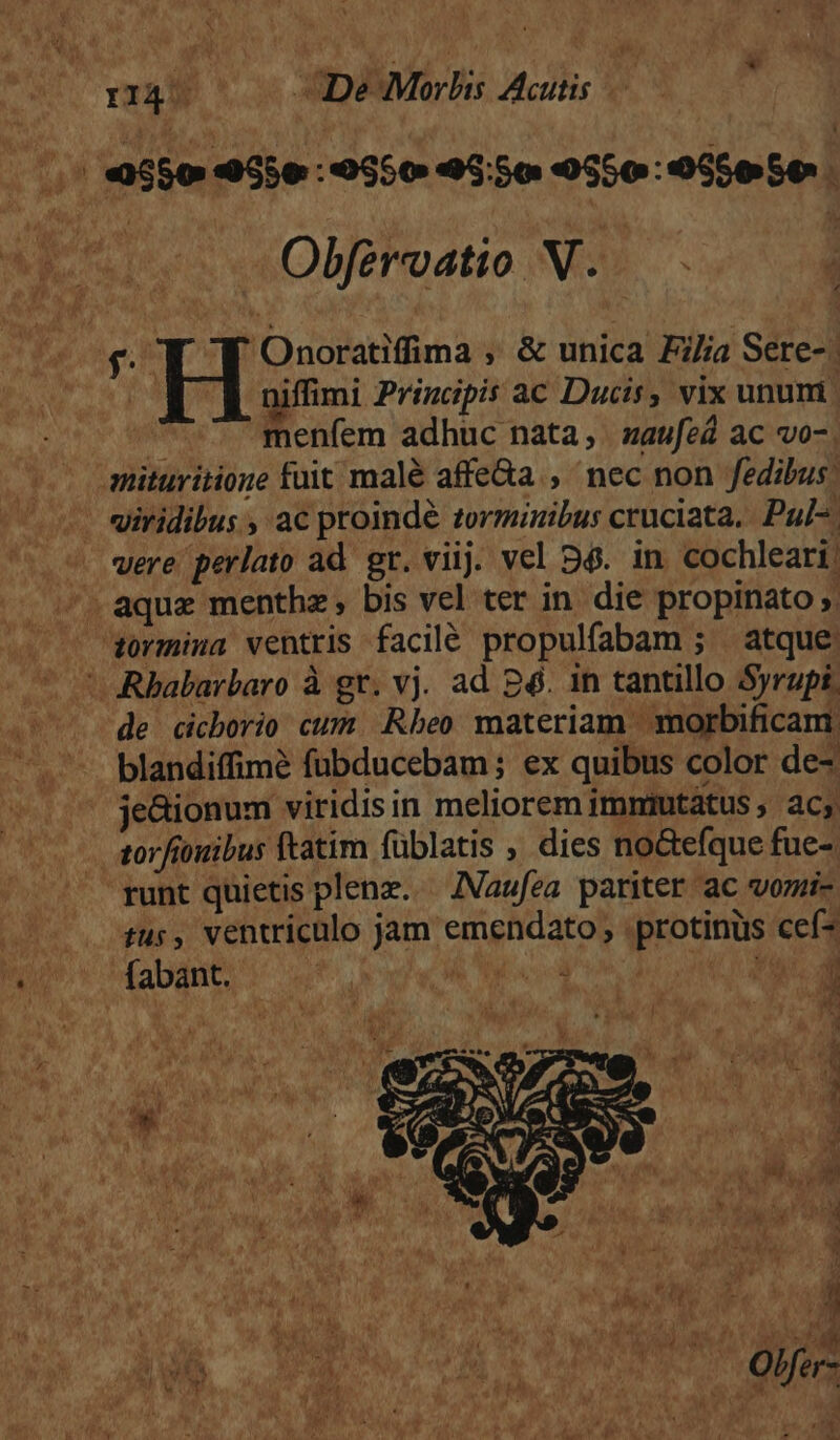 : ru Tos MD Acitis | /; *56 46e : 0550 45:50 0550: 055050. Obfervatio N. | p 'Onoratiffima , &amp; unica Filia Sere-. A niffimi Principis ac Ducis, vix unum | menfem adhuc nata, zaufed ac vo-. mituritione fuit malé affe&amp;a , nec non fedibus. -. viridibus , ac proindé torminibus cruciata.. Pul- were perlato ad gr. viij. vel 54. in cochleari ^. aque menthz, bis vel ter in. die propinato ». tormina ventris facilé propulfabam ; atque 'ARbabarbaro à gr. vj. ad 26. 1n tantillo Syrupi, de cicborio cum Rbeo materiam morbificam blandiffimé fübducebam; ex quibus color de- je&amp;ionum viridis in meliorem imniutatus ; ac; - stor fiouibus ftatim füblatis , dies no&amp;efque fue-. 'runt quietis plenz. —ZVaufea pariter ac vomi- tus, ventriculo jam emendato protinus cef dvo fabant. | Pri a 4 L4 * : | j | » P : 2): | d$ : j EN d j E | 81 1 ) n TI. 4 ^ P L2  r A i LU ; '