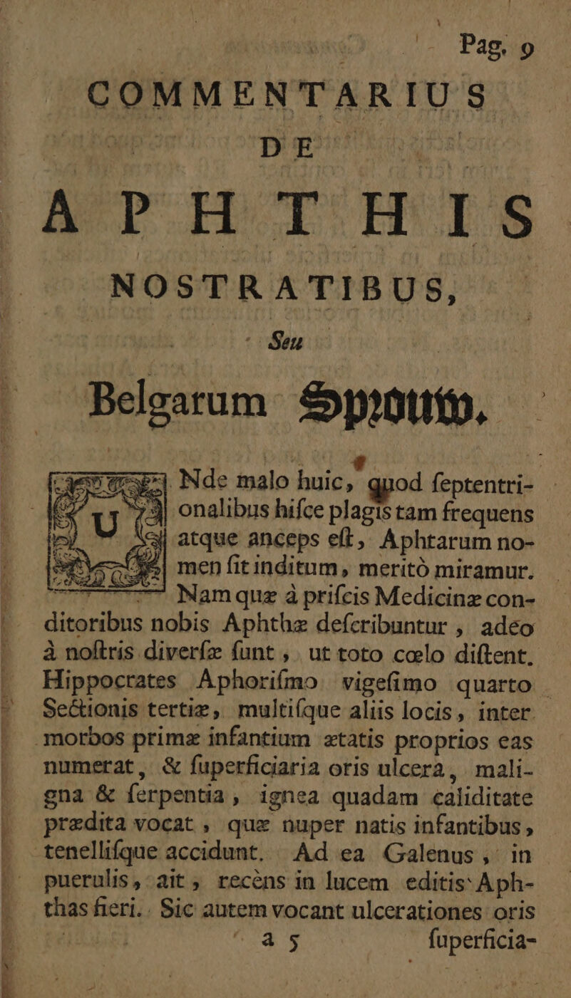 ELT |GOMMENTARIU E DE APHTHIS NOSTRATIBUS, : (dia M eum Spi. 7E Nde malo huic, 4 od PURUS 73 onalibus hifce plagis tam frequens Qi atque anceps eft, Aphtarum no- fyc 6| men fit inditum, meritó miramur. 7-7 7- Namque à prifcis Medicinz con- eris: nobis Aphthz defcribuntur ,, adeo à noftris diveríz funt ,. ut toto colo diftent. Hippocrates Aphorifmo. vigefimo quarto . Setionis tertiz, multi(que aliis locis, inter. morbos primsx infantium atatis proprios eas numerat, &amp; fuperficiaria oris ulcera, mali- gna &amp; (érpentia » ignea quadam caliditate przdita vocat , que nuper natis infantibus , tenellifque accidunt, Ad ea Galenus, in puerulis, ait, recens in lucem editis: Aph- thas fieri.. Sic autem vocant ulcerationes oris NS à s fuperficia-