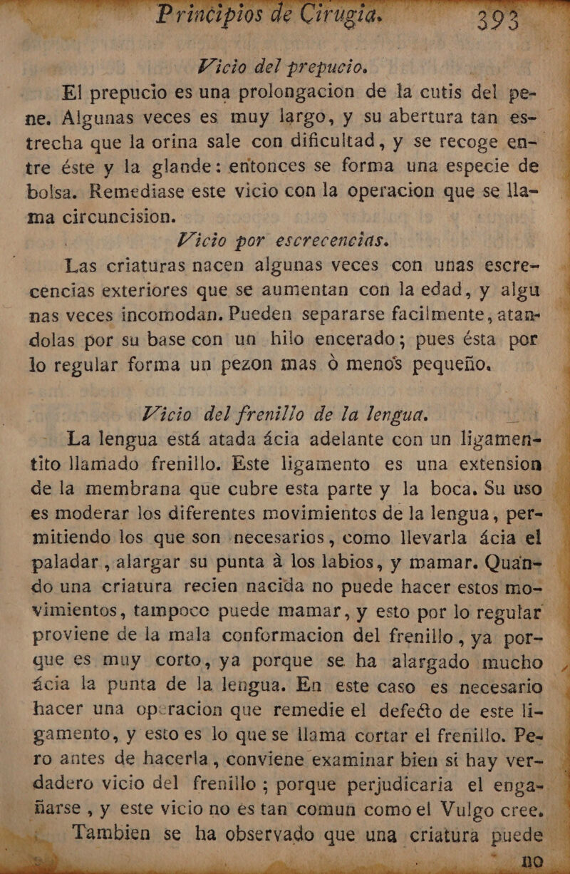 Vicio del prepucio. El prepucio es una prolongación de la cutis del pe- ne. Algunas veces es muy largo, y su abertura tan es- tre éste y la glande: entonces se forma una especie de bolsa. Remediase este vicio con la operacion que se lla-= ma circuncision. Vicio por escrecencias. Las criaturas nacen algunas veces con unas escre- cencias exteriores que se aumentan con la edad, y algu nas veces incomodan. Pueden separarse facilmente, atan- dolas por su base con un hilo encerado; pues ésta por lo regular forma un pezon mas o menos pequeño. Vicio del frenillo de la lengua. bas - La lengua está atada ácia adelante con un ligamen= : tito llamado frenillo. Este ligamento es una extension. de la membrana que cubre esta parte y la boca. Su uso : es moderar los diferentes movimientos de la lengua, per= mitiendo los que son necesarios, como llevarla ácia el paladar, alargar su punta a los labios, y mamar. Quan= do una criatura recien nacida no puede hacer estos mo= vimientos, tampoce puede mamar, y esto por lo regular proviene de la mala conformacion del frenillo, ya por- que es muy corto, ya porque se ha alargado mucho , ácia la punta de la lengua. En este caso es necesario hacer una operacion que remedie el defeéto de este li- gamento, y esto es lo que se llama cortar el frenillo. Pe= 1 ro antes de hacerla, conviene examinar bien si hay ver= dadero vicio del frenillo ; porque perjudicaria el enga= Marse , y este vicio no es tan comun como el Vulgo cree. Tambien se ha observado que una criatura puede