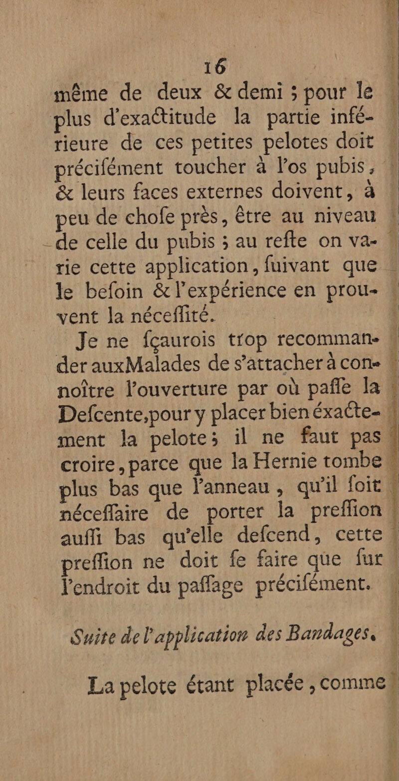 même de deux &amp; demi ; pour le plus d'exactitude la partie infé- rieure de ces petites pelotes doit précifément toucher à los pubis, ! &amp; leurs faces externes doivent, à * peu de chofe près, être au niveau _ de celle du pubis ; au refte on va- rie cette application, fuivant que le befoin &amp; l’expérience en prou- vent Ja néceffité. Je ne fçaurois trop recomman- # der auxMalades de s'attacher à cone “ noître l'ouverture par où pañle la &amp; Defcente;pour y placer bien éxacte- W ment la pelote; il ne faut pas croire, parce que la Hernie tombe plus bas que anneau , qu'il foit + néceflaire de porter la preflion ! auffi bas qu'elle defcend, cette # preffion ne doit fe faire que fur l'endroit du paffage précifément. 4 Suite de l'application des Bandages, La pelote étant placée , commen