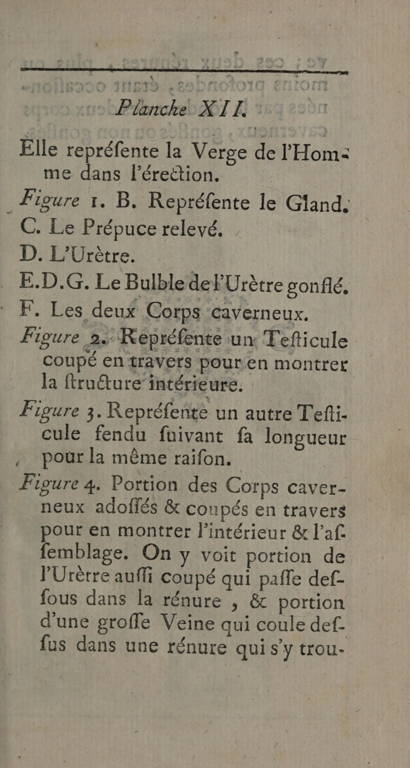 Le Pétriche XTA Elle repréfente la Verge de l'Hom: me dans l'érection. . Figure 1. B. Repréfente le Gland. C. Le Prépuce relevé. D. L’Urètre. E.D.G. Le Bulble del Urètre gonflé, : F, Les deux Corps caverneux. Figure 2. KRepréfente un Tefticule Coupé en travers pour en montrer la ftruéture’ intérieure. | Figure 3. Repréfenté un autre Tefti- cule fendu fuivant fa longueur , pour la même raifon. Figure 4. Portion des Corps caver- neux adofiés &amp; coupés en travers pour en montrer l’intérieur &amp; l’af femblage. On y voit portion de PUrètre auffi coupé qui pafle def- fous dans la rénure , &amp; portion d'une groffe Veine qui coule def. fus dans une rénure qui s’y trou-