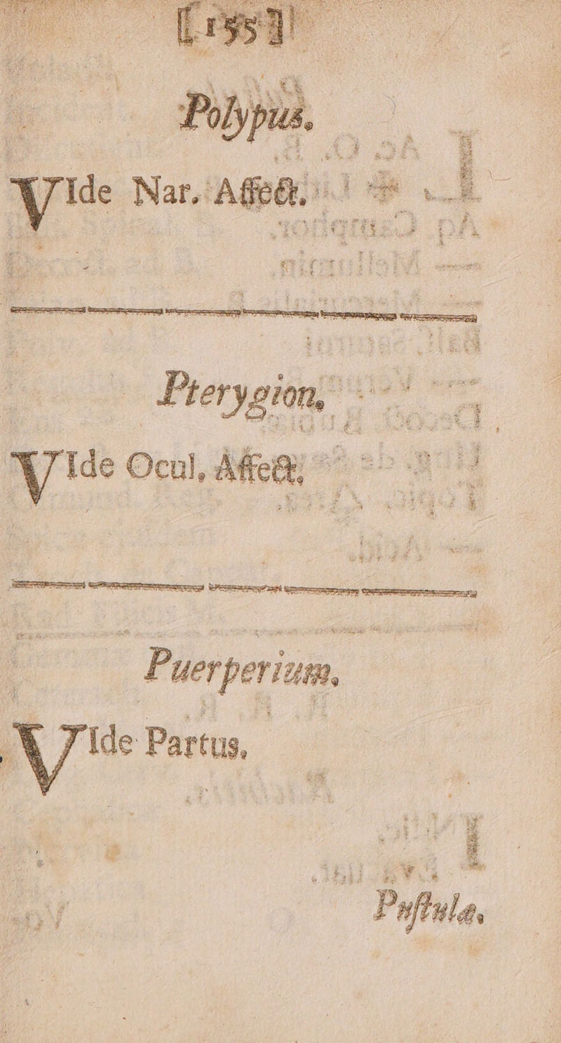 Purperi. ) As Partus