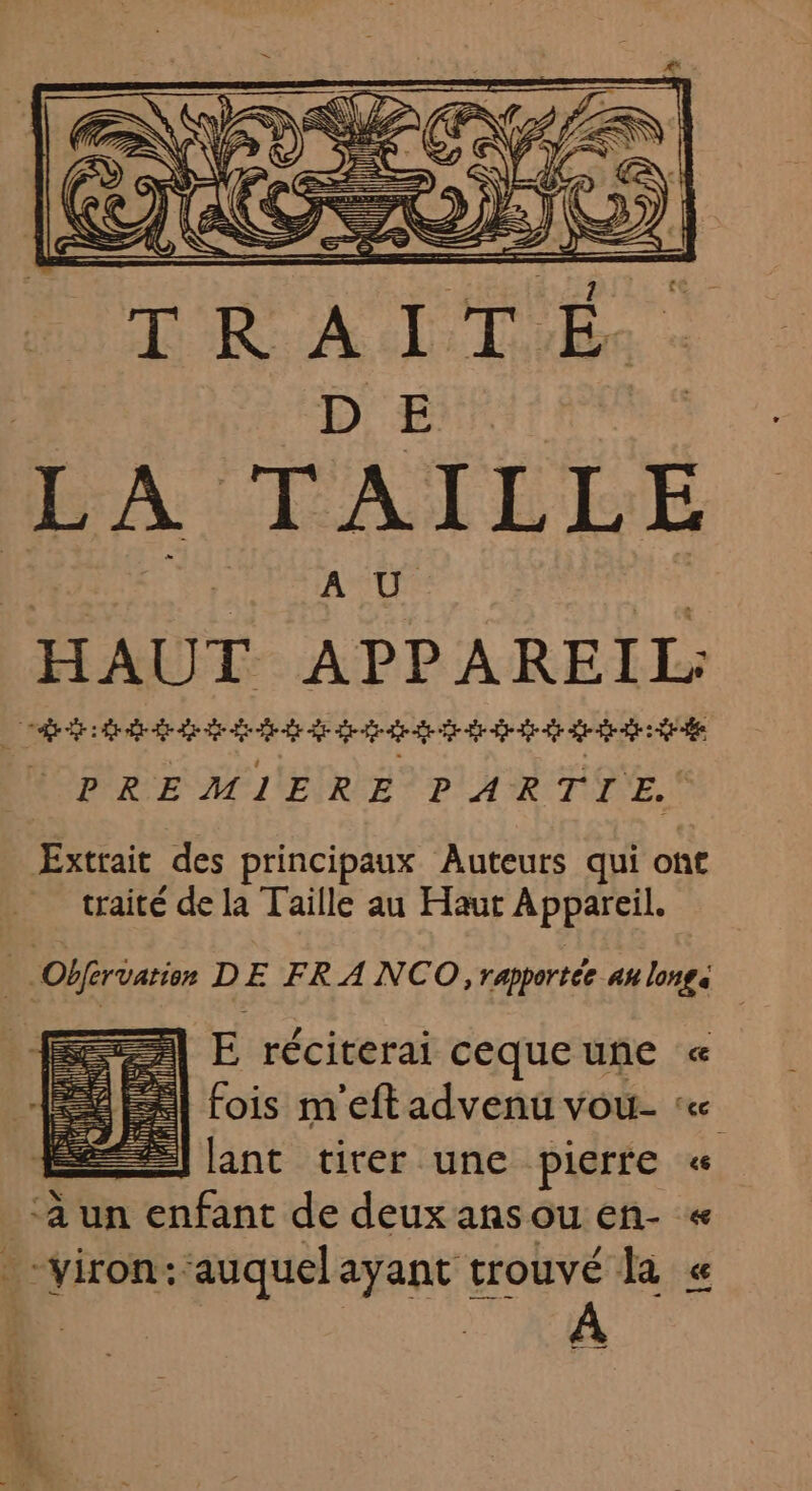 Extrait des principaux Auteurs qui ont traité de la Taille au Haut Appareil. | | Obfervation DE FRA NCO, rapportée an longe E réciterai cequeunñe « | fois m'eft advenu vou- « É] lant tirer une pierre « e X y ‘a un enfant de deuxansouen- « .-viron:auquel ayant trouvé la « - —