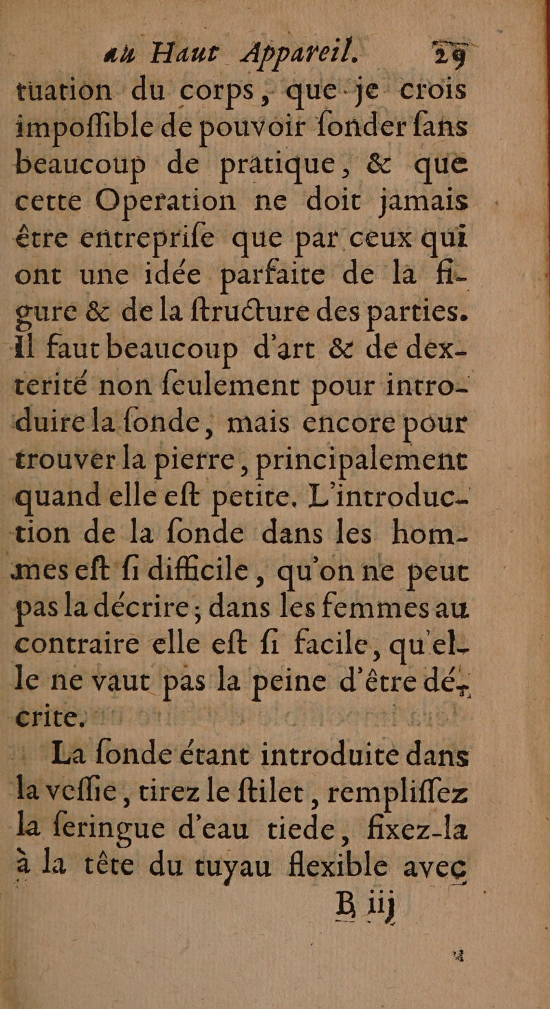 tüation du corps, que je crois impoffible de pouvoir fonder fans beaucoup de pratique, &amp; que cette Operation ne doit jamais être entreprile que par ceux qui ont une idée parfaite de la fi- gure &amp; de la ftructure des parties. ‘Al fautheaucoup d'art &amp; de dex- terité non feulement pour intro- duirela fonde, mais encore pour trouver la pierre, principalement “quand elle eft petite, L'introduc- tion de la fonde dans les hom- mes eft fi dificile, qu'on ne peut pas la décrire; dans les femmesau contraire elle eft fi facile, quel. le ne vaut pas la peine d’être dé, SFILCY EE 0 | $ COPTEREU SN .: : La fonde étant introduite dans Ja veflie, tirez le ftilet, rempliffez la feringue d’eau tiede, fixez-la à la tête du tuyau flexible avec