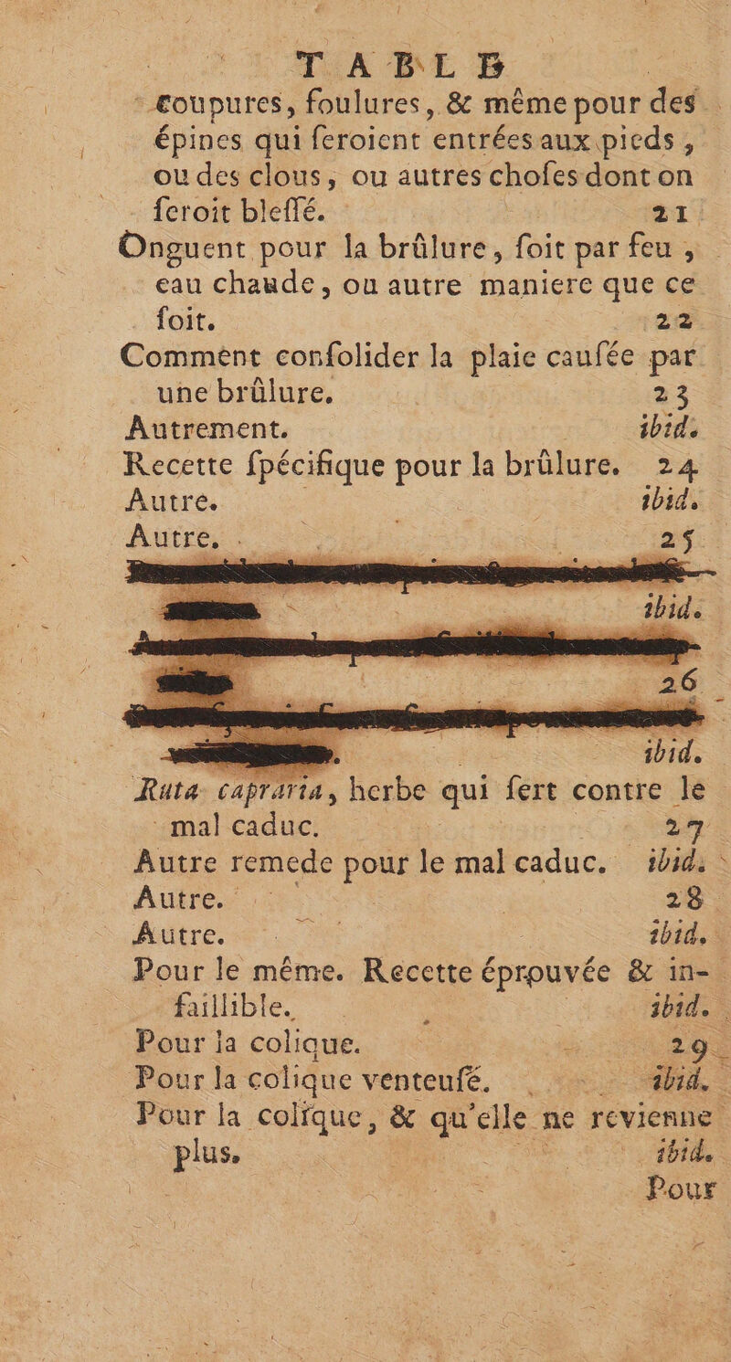 TAB L EF | coupures, foulures, & même pour des. épines qui feroient ‘entrées aux pieds , ou des clous, ou autres chofes dont on feroit bleffé. 21. Onguent pour la brûlure, foit par feu , eau chaude, ou autre maniere que ce foit. é 22 Comment confolider la plaie caufée par une brûlure, 23 Autrement. ibid. Recette fpécifique pour la brûlure. 24 Autre. ibid, Autos ne. | ia: | ibid. ; — Ruta caprarta, herbe qui fert contre le mal caduc. 2 Autre remede pour le mal caduc. ibid: Autre. 28. Aire ei ibid. Pour le même. Recette éprouvée & in-. faillible ; ibid. Pour ja colique. ns #2. Pour la colique venteufé, +: id. Pour la colique, & qu ‘lle ne revienne plus. | Re Pour v.