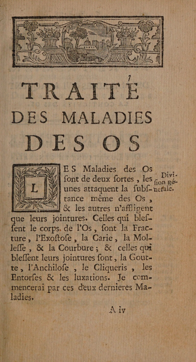 = han. WE = SR Fe AN SSS 5 rs DES MALADIES DES O5 ZANYIES Maladies des Os NY | font de deux fortes , les &amp; ke j} unes attaquent la fubf- nerale. | tance même des Os, ss @% les autres naflligent que nr jointures. Celles qui blef- fent le corps. de l’Os, font la Frac- ture, l’Exoftofe , la Carie, la Mol- leffe , &amp; la Courbure; &amp; celles qu bleffent leurs jointures font, la Gout- pr = Entorfes &amp; les luxations. Je com- *mencerai par ces deux dernieres Ma- _ Ladies, | La