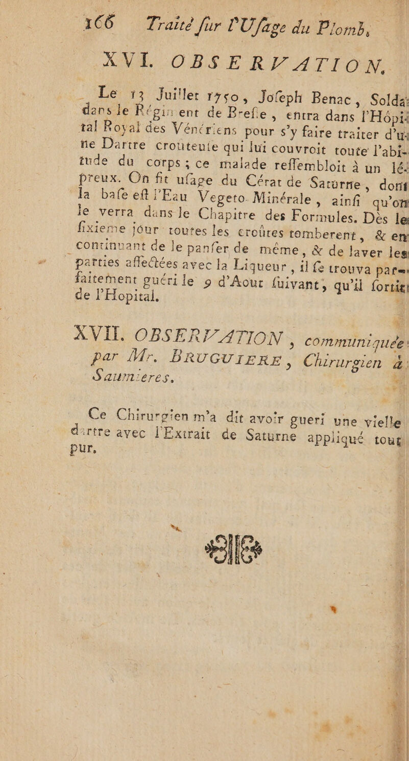 1C8 Traire Jur PU age du Pons. : XVI. OBSE REF ATION. . Le :3 Juillet r760, Jofeph Benac, Soldai dans le Régin ent de Brefie, entra dans l'H6pi: tal Royal des Vénériens pour s’y faire traiter d’u: ne Dartre crouteute qui lui couvroit toute l’abiz tude du corps; ce malade reflembloit à un lé. preux. On fit ufage du Cérar de Saturne, dorif la bafe eft l'Eau Vegeto. Minérale, ainf qu’on le verra dans le Chapitre des Formules. Dès le fixieme jour toutes les croûres tomberent, &amp; en continuant de le panfer de même, &amp; de laver les _ parties affeQ@ées avec la Liqueur , il f trouva pars faitement guéri le 9 d’Aour luivant, qu’il fortit de l'Hopital. Li XVII. OBSERF ATION » COMMUNIQUE: par Mr. BRU GUIERE, Chirurgien &amp;. Sazumieres. Ne Ce Chirurgien m'a dit avo!r gueri une vielle dirtre avec l'Extrait de Saturne appliqué toug pur, Le LES