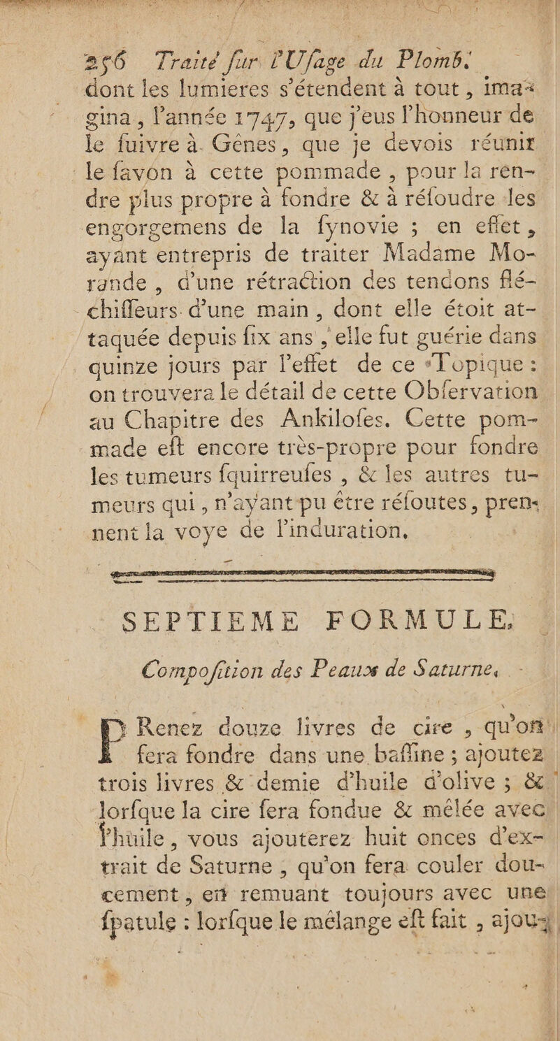 roule fé al he dis Ce VS ELLE CSS ARC SCO RE POP ETS 266 Traité fur L'Ufage du Plomb. dont les lumieres s'étendent à tout, ima* gina , l’année 1747, que j'eus lhonneur de le fuivre à. Gênes, que je devois réunir le favôn à cette pommade , pour la rén- dre plus propre à fondre &amp; à réfoudre les engorgemens de la fynovie ; en efet, ayant entrepris de traiter Madime Mo- rande , d’une rétraétion des tencons flé- - chiffeurs. d’une main, dont elle étoit at- taquée depuis fix ans , elle fut guérie dans quinze jours par l'effet de ce “T[opique : on trouvera le détail de cette Obfervation au Chapitre des Ankilofes. Cette pom- made eft encore très-propre pour fondre les tumeurs fquirreufes , &amp; les autres tu- meurs qui, n'ayant pu étre réloutes, pren« nent la voye de linduration, _ Wen esse SEPTIEME FORMULE, Compofition des Peau de Saturne, y Renez douze livres de cire , qu'of!| fera fondre dans une baffine ; ajoutez trois livres &amp; demie d'huile d'olive ; &amp;. Jorfaue la cire fera fondue 8: mélée avec ’hüile, vous ajouterez huit onces d’ex-, trait de Saturne , qu'on fera couler dou- cement , er remuant toujours avec une fpatule : lorfque le mélange eft fait , ajou-|, <e- À