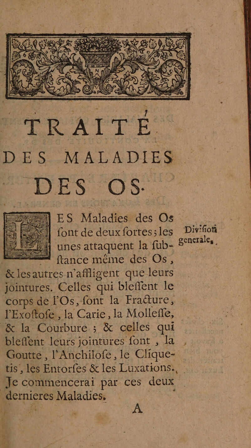 DES MALADIES NES OS ES Maladies des Os font de deuxfortes;les Divifon | unes attaquent la fub- Rae | ue ftance même des Os, &amp; lesautres n'affigent que leurs jointures. Celles qui bleflent le corps de FOs, font la Fracture, J'Exoftofe., la Carie, la Molleñle, &amp; la Courbure ; &amp; celles qui bleflent leurs jointures font , la , Goutte , l'Anchilofe, le Clique- tis, les Entorfes &amp; les Luxations., | Je commencerai par ces deux dernieres Maladies, 14 “ | k À 1 pee Jr re