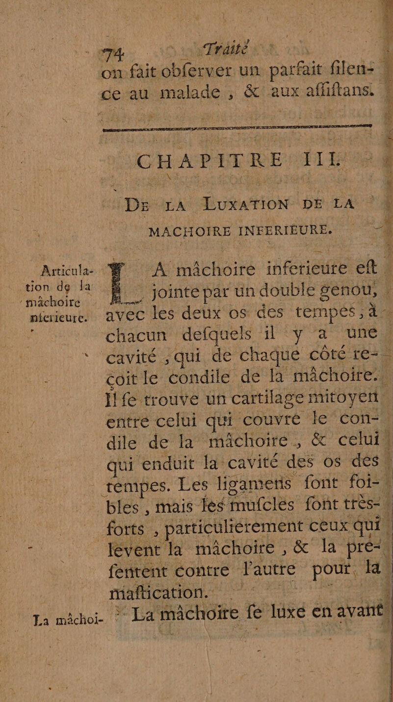 Articula- tion de la mâchoire nicrieure. % La mâchoi- Trait DE LA ÉLUXATION DE LA Ce) chacun defquels il y ‘a une L maftication. È À Ai #4)
