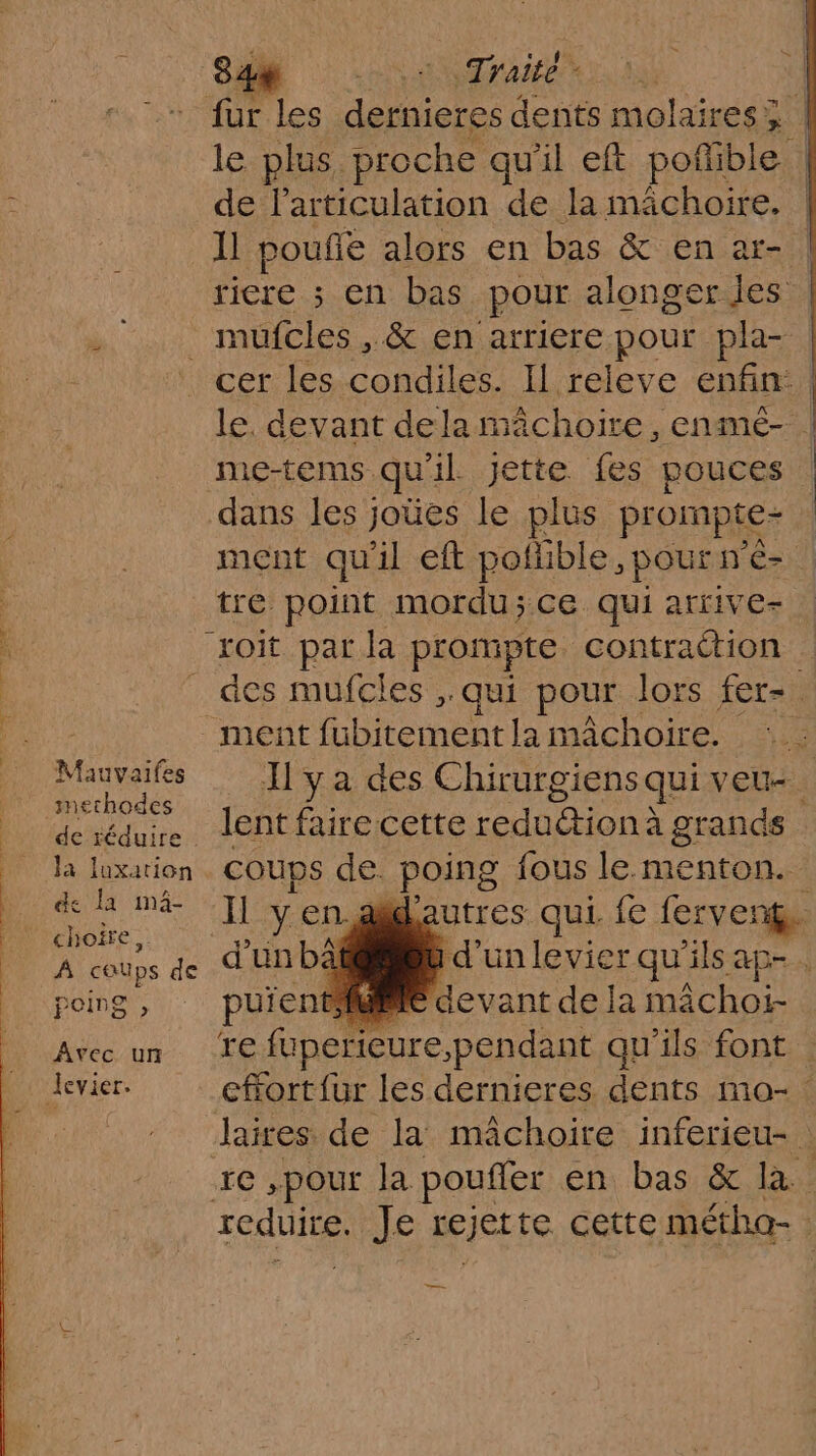c”à de l'articulation de la mächoire. 1 poue alors en bas &amp; en ar- ricre ; en bas pour alonger les mes _&amp; en arriere pour pla- ne ifes methodes de réduire : Ja luxation de la mi- choire,. A caups us poing , Avec un levier. me-tems. qu 1 jette fes pouces dans les joües le plus prompte- ment qu il eft pofible, pour p'é-. tre point mordu;ce qui arrive- roit par la prompte contraétion - ment fubitement la mâchoire. as de. poing fous le.menton. —