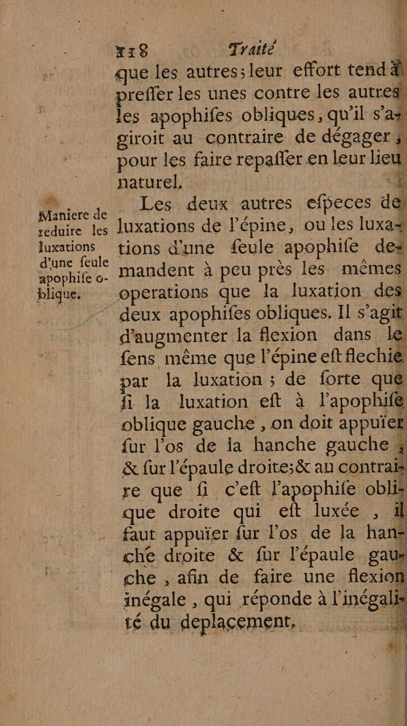 Maniere de reduire les Juxations d'une feule apophile c- blique, à 4 N19, Traité À que les autressleur effort tend äl preffer les unes contre les ne les apophifes obliques, qu'il sax giroit au contraire de dégager s pour les faire repañler en leur lieu, naturel, F2, Les deux autres efbeces del luxations de l’épine, ou les luxas tions d'une feule apophife dex mandent à peu près les mêmes. d'augmenter la flexion dans le fens même que lépine eft fechié par la luxation ; de forte que fi la luxation eft à l’apophife oblique gauche , on doit appuiek fur l'os de la hanche pauche 4 &amp; fur l'épaule droite;&amp; au contrai re que fi c’eft l’apophife oblis que droite qui eft luxée , il che droite &amp; fur l'épaule gaur che , afin de faire une flexion inégale , qui réponde à l'inégalis té du deplacement, É é |