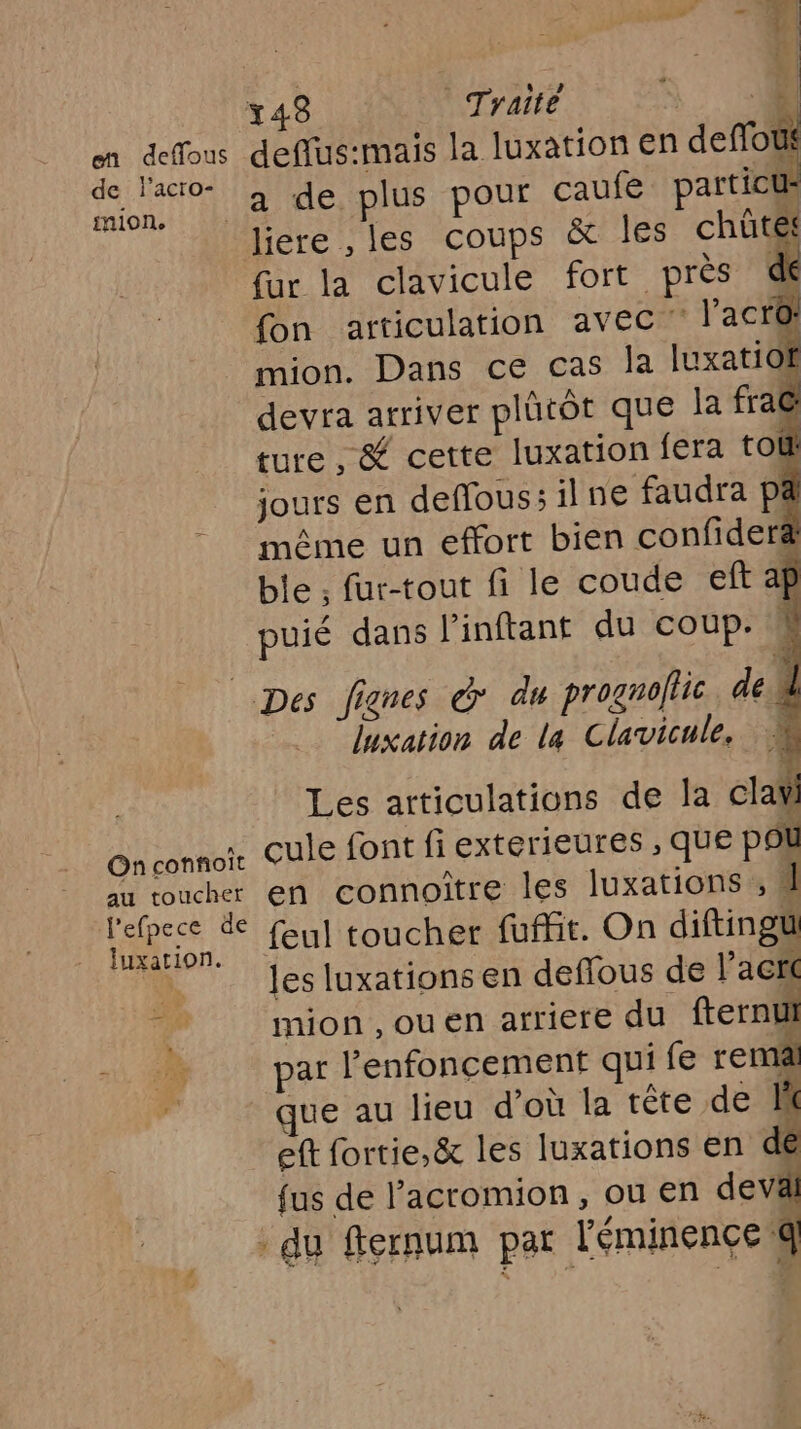 343 Traité | GA ao deffus:mais la luxation en deflouf nr ME) RIDE POUT caufe particus liere ,les coups &amp; les chütes fur la clavicule fort près de fon articulation avec l’acro mion. Dans ce cas la luxatiof devra arriver plütôt que la fra@ ture, &amp; cette luxation fera tou jours en deffous; il ne faudra p&amp; même un effort bien confiderä ble ; fur-tout fi le coude eft ap Re: puié dans l'inftant du coup. À Des figues &amp; du prognoflic de 4 luxation de la Clavicule, 4 Les articulations de la claÿ Onconnoù Cule font fi exterieures , que pou au toucher en connoître les luxations , 1 lefpece # feul toucher fuit. On diftingu LM les luxations en deflous de l'acte “ mion ,ouen arriere du fternui ; par l’enfoncement qui fe remä que au lieu d’où la tête «2 eft fortie,&amp; les luxations en dé fus de lacromion, ou en deväl : du ffernum par l'éminençe À + LS F
